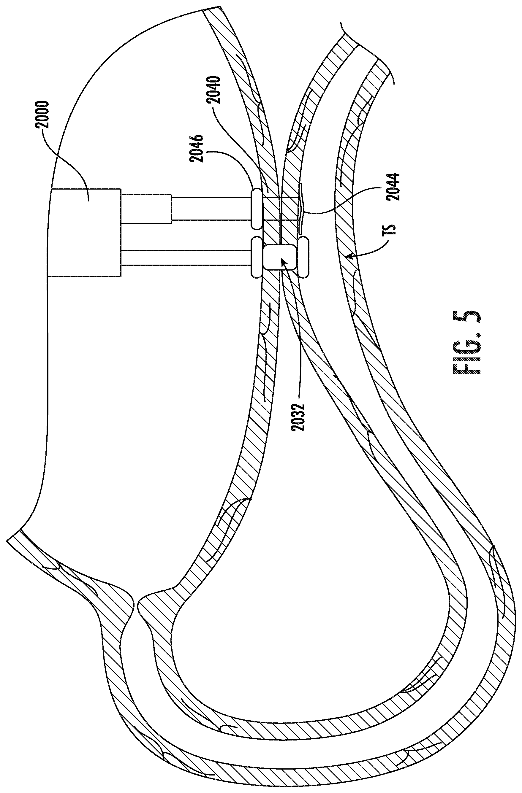 Patent US12611285 Figure 5 – Wireless devices, systems, and methods for endoscopic positioning