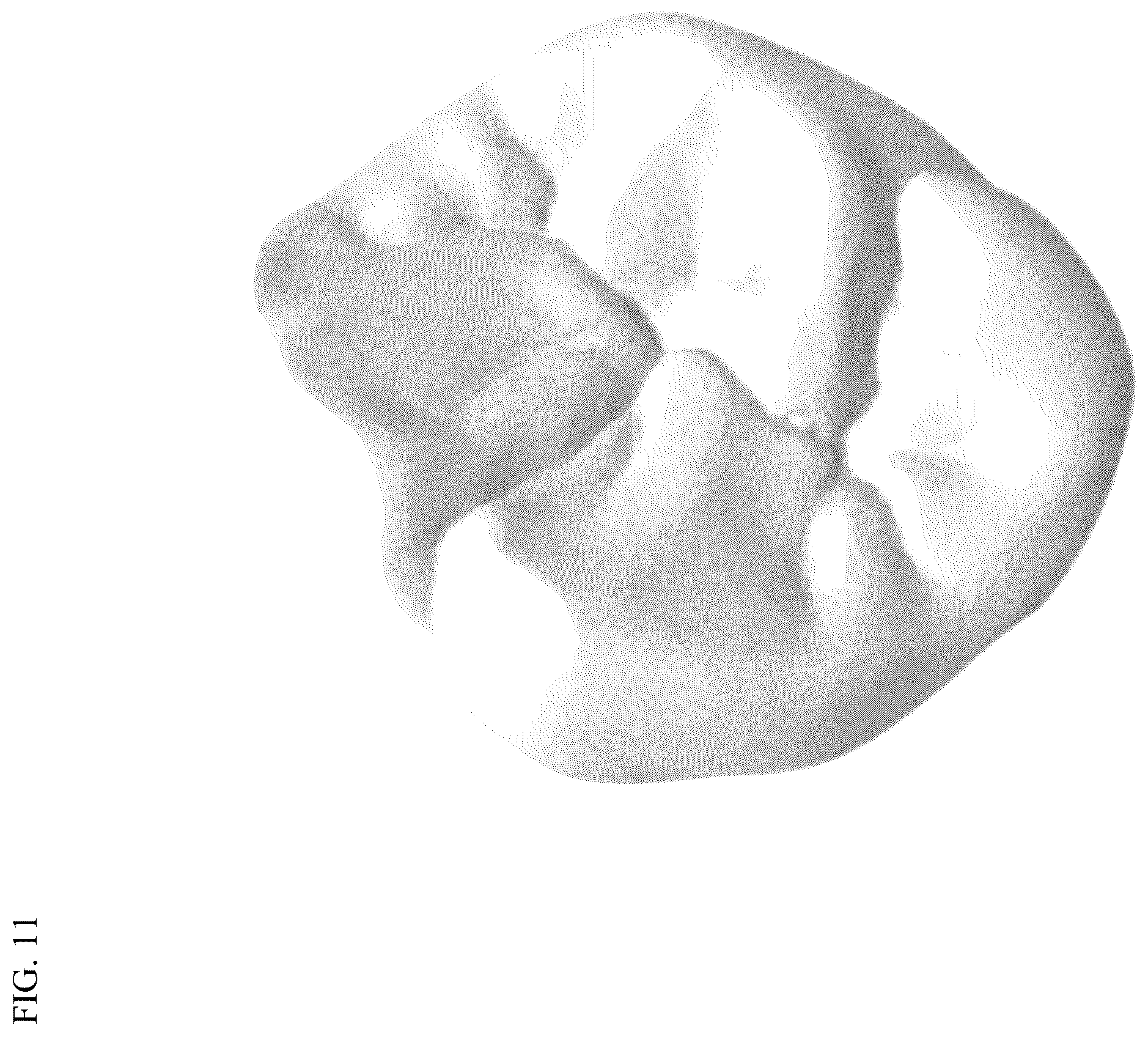 Patent US12611286 Figure 8 – Method and apparatus for dental crown restorations using prefabricated sleeve-crown pairs