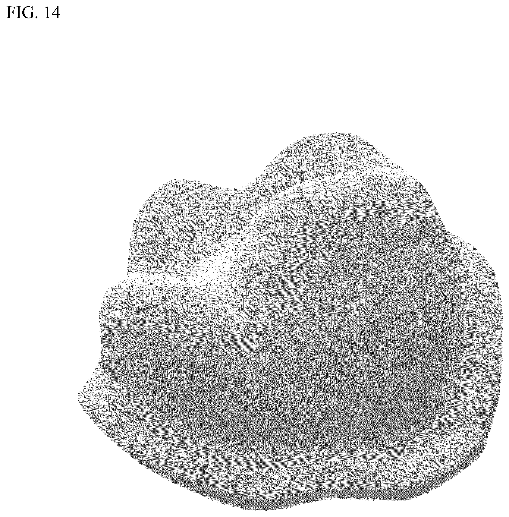 Patent US12611286 Figure 11 – Method and apparatus for dental crown restorations using prefabricated sleeve-crown pairs