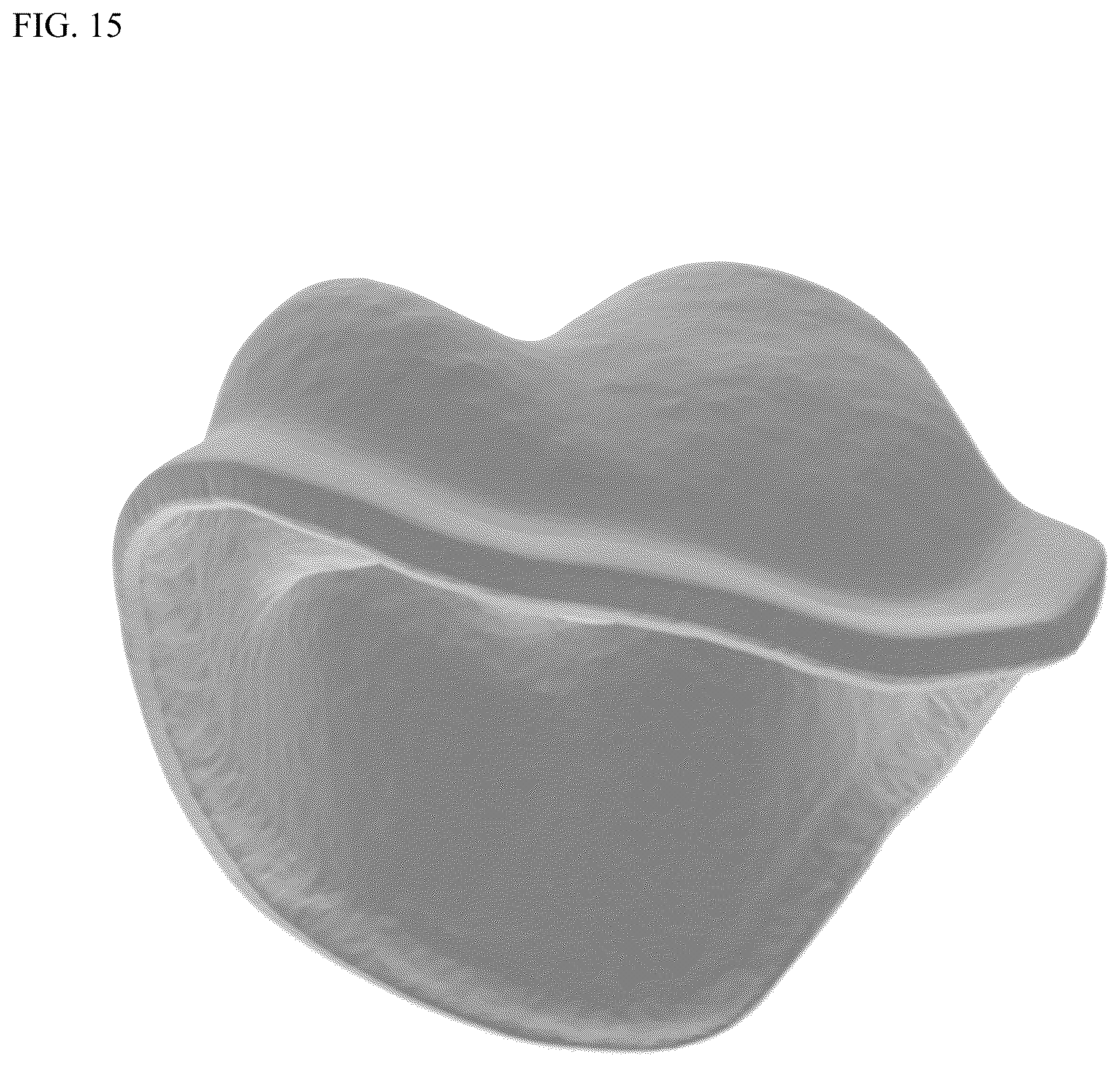Patent US12611286 Figure 12 – Method and apparatus for dental crown restorations using prefabricated sleeve-crown pairs