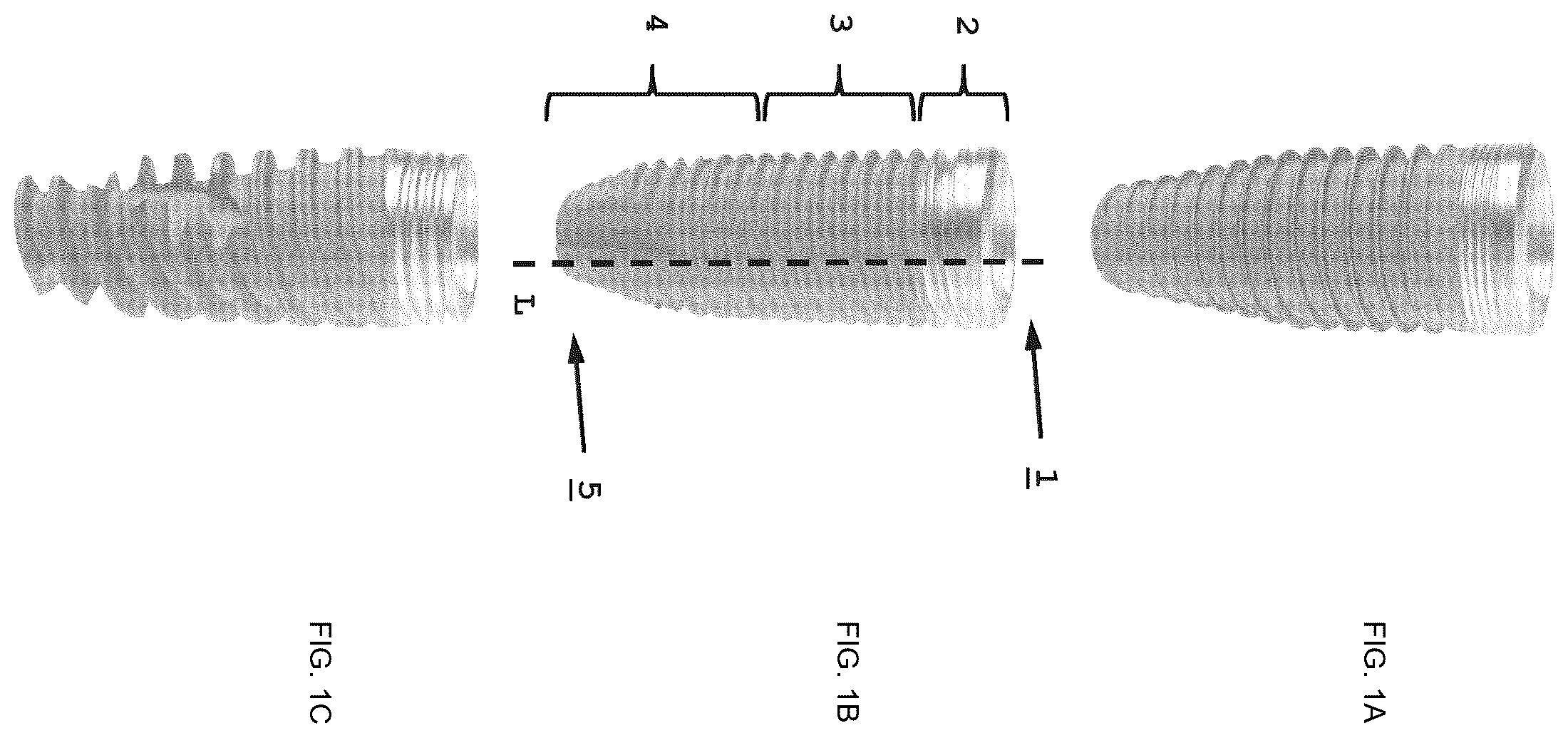 Patent US12611288 Figure 1 – Dental implant, component for dental applications, implant system for dental applications, method for forming a protective layer on the surface of an implantable or implant component, implantable or implant component having a protective layer, and use of a protective layer