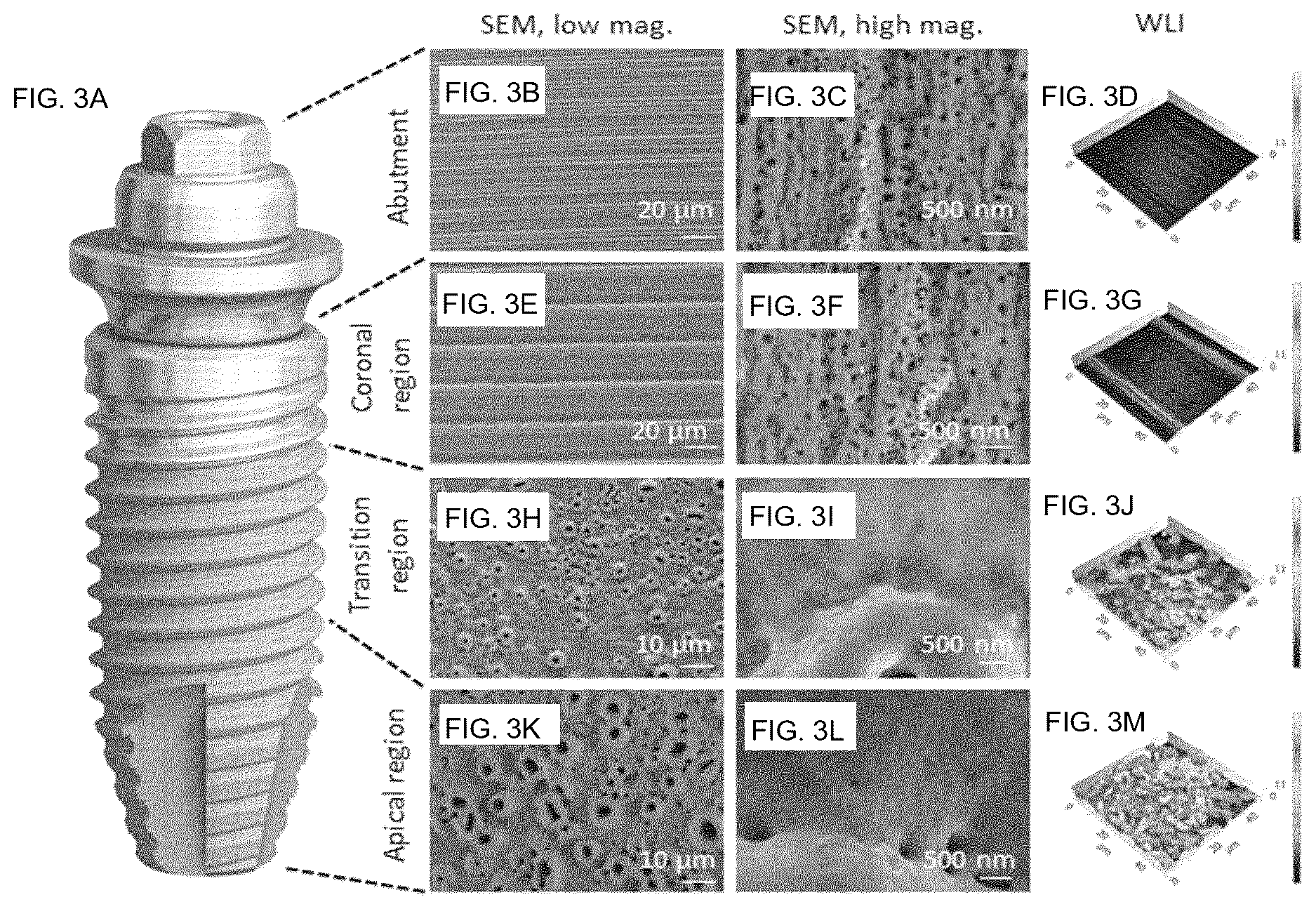 Patent US12611288 Figure 3 – Dental implant, component for dental applications, implant system for dental applications, method for forming a protective layer on the surface of an implantable or implant component, implantable or implant component having a protective layer, and use of a protective layer