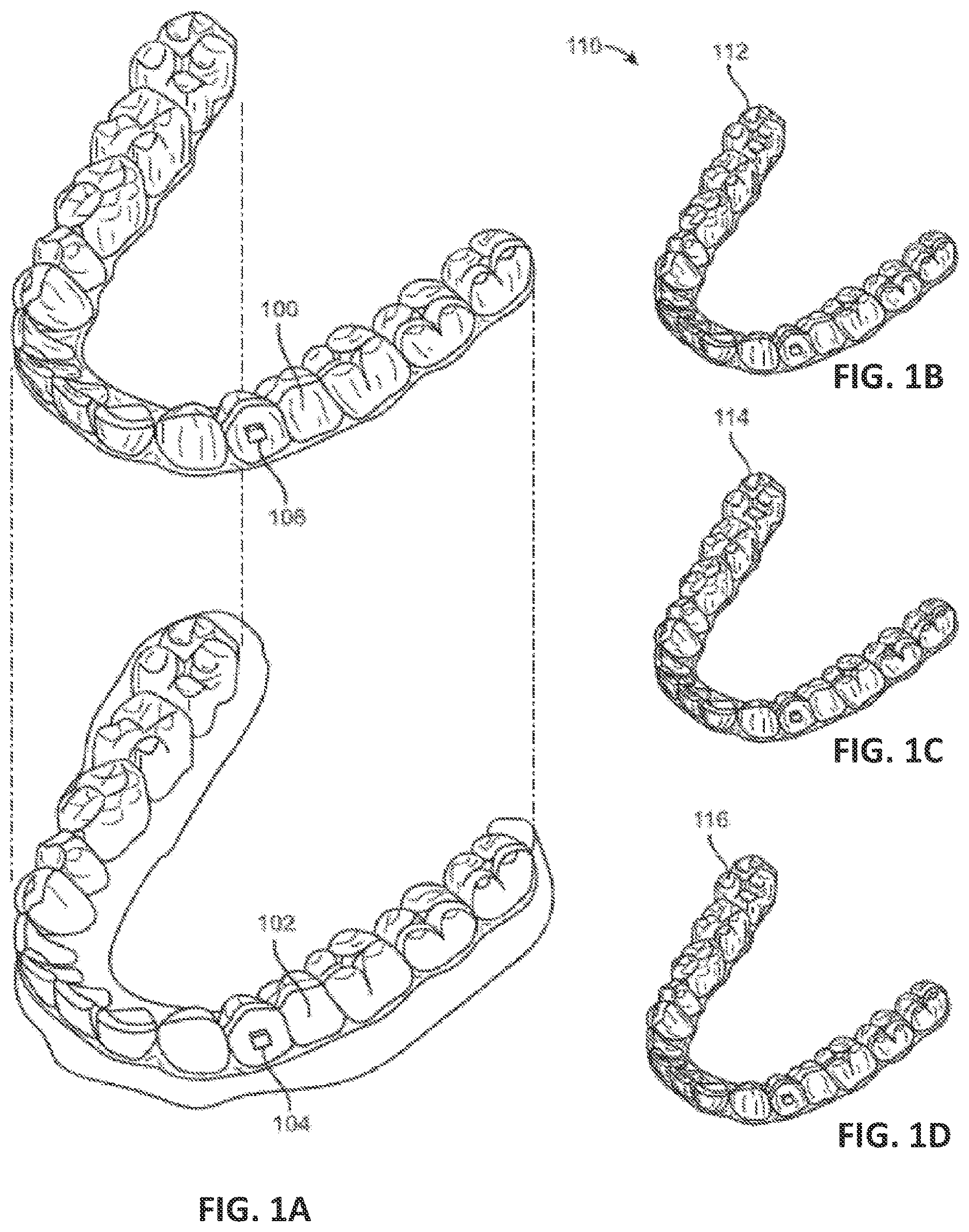 Patent US12611291 Figure 1 – Biosensor performance indicator systems for orthodontic appliances