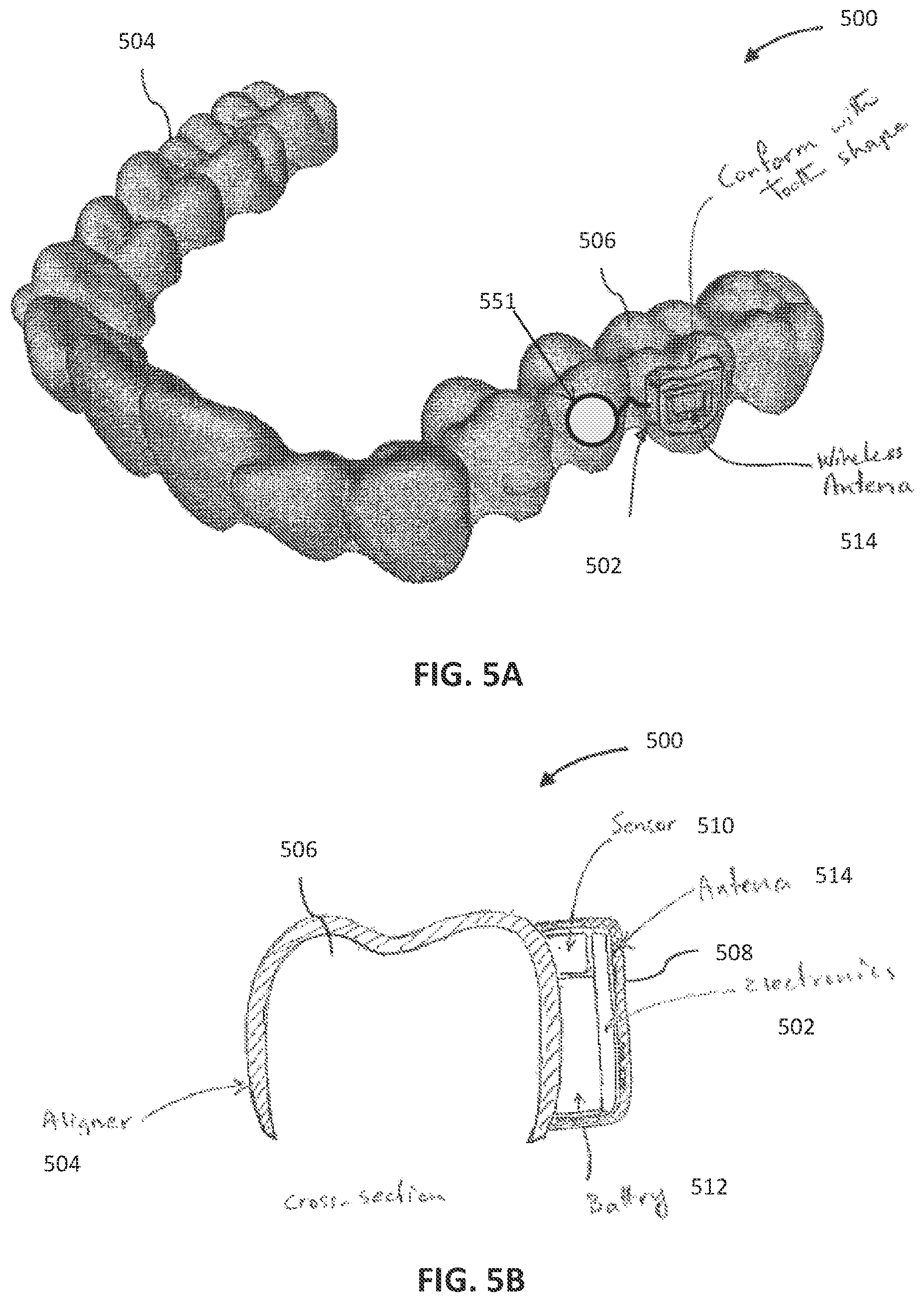 Patent US12611291 Figure 6 – Biosensor performance indicator systems for orthodontic appliances