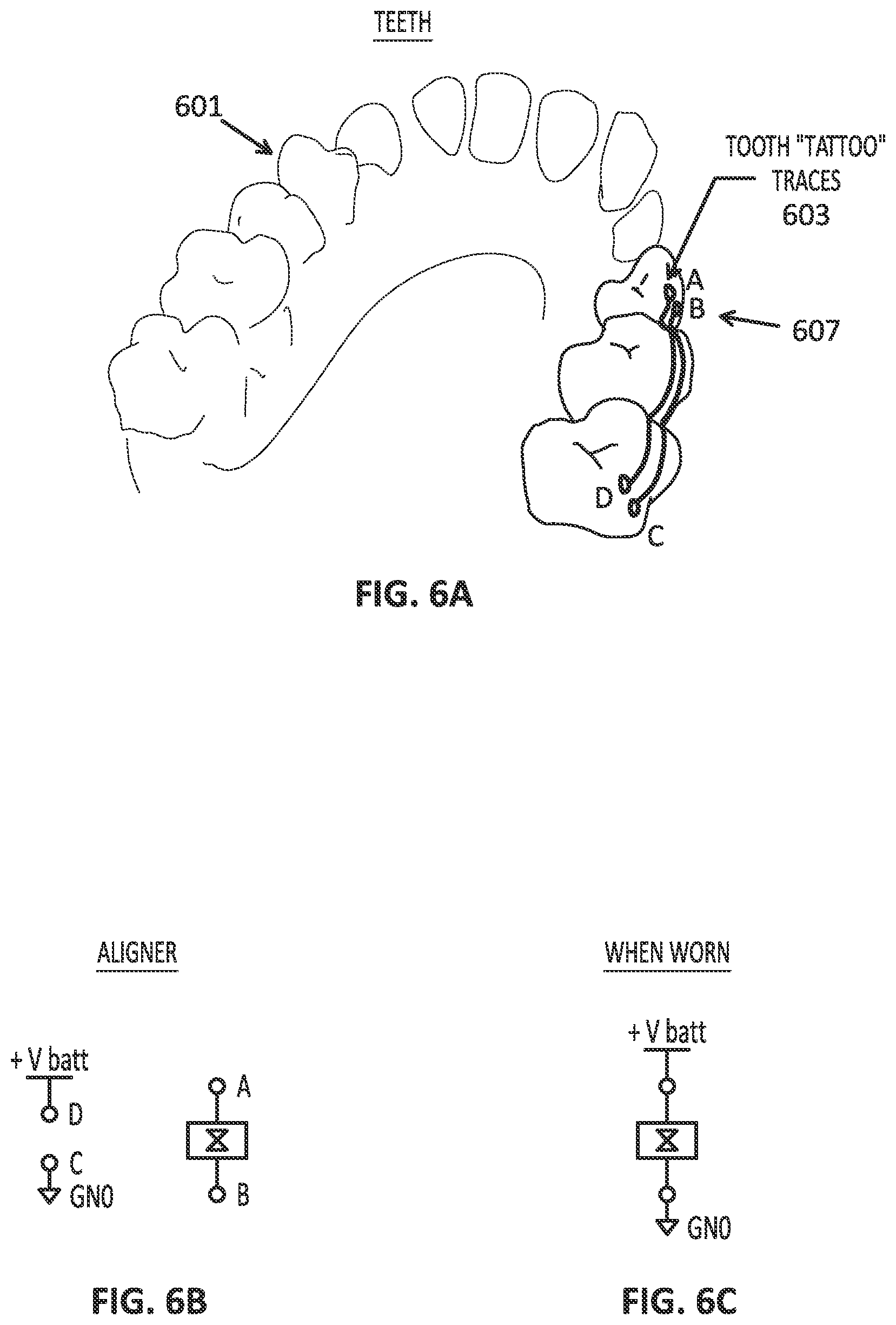 Patent US12611291 Figure 7 – Biosensor performance indicator systems for orthodontic appliances