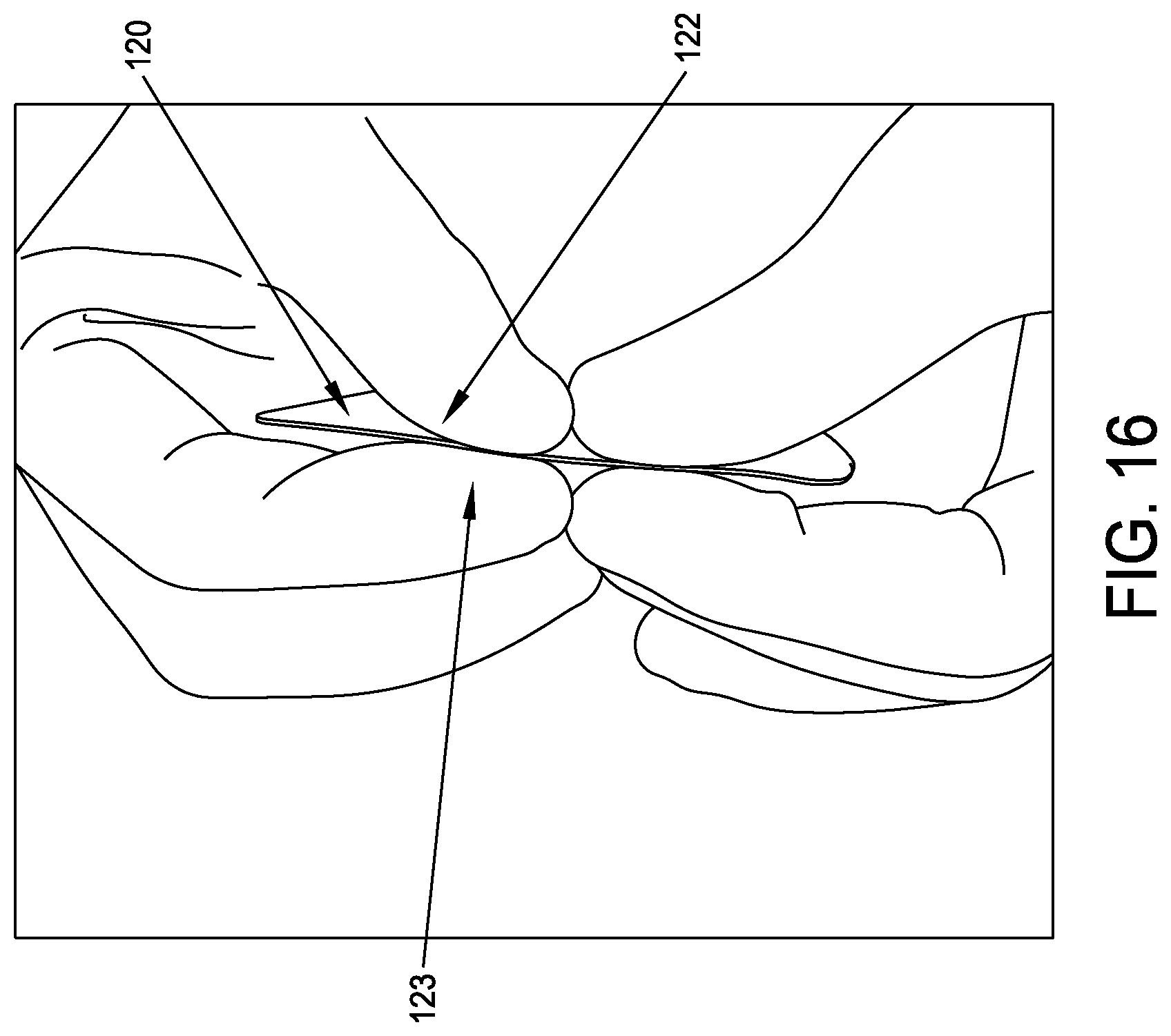 Patent US12611293 Figure 16 – Surgical mesh having ingrowth-preventing coating on one side thereof, and method for making the same