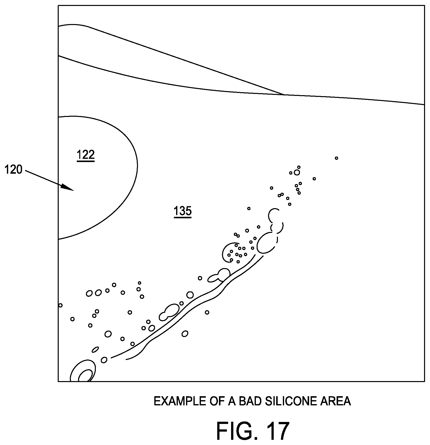 Patent US12611293 Figure 17 – Surgical mesh having ingrowth-preventing coating on one side thereof, and method for making the same
