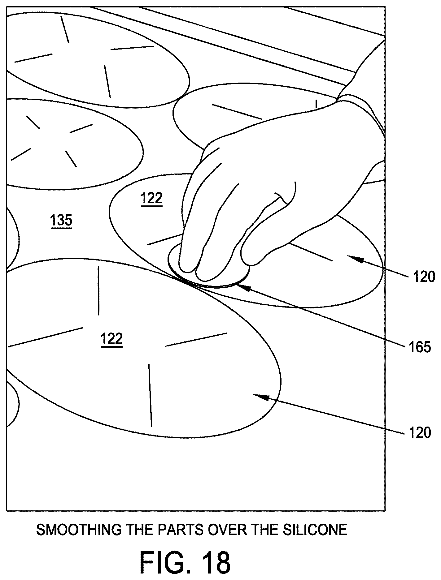 Patent US12611293 Figure 18 – Surgical mesh having ingrowth-preventing coating on one side thereof, and method for making the same
