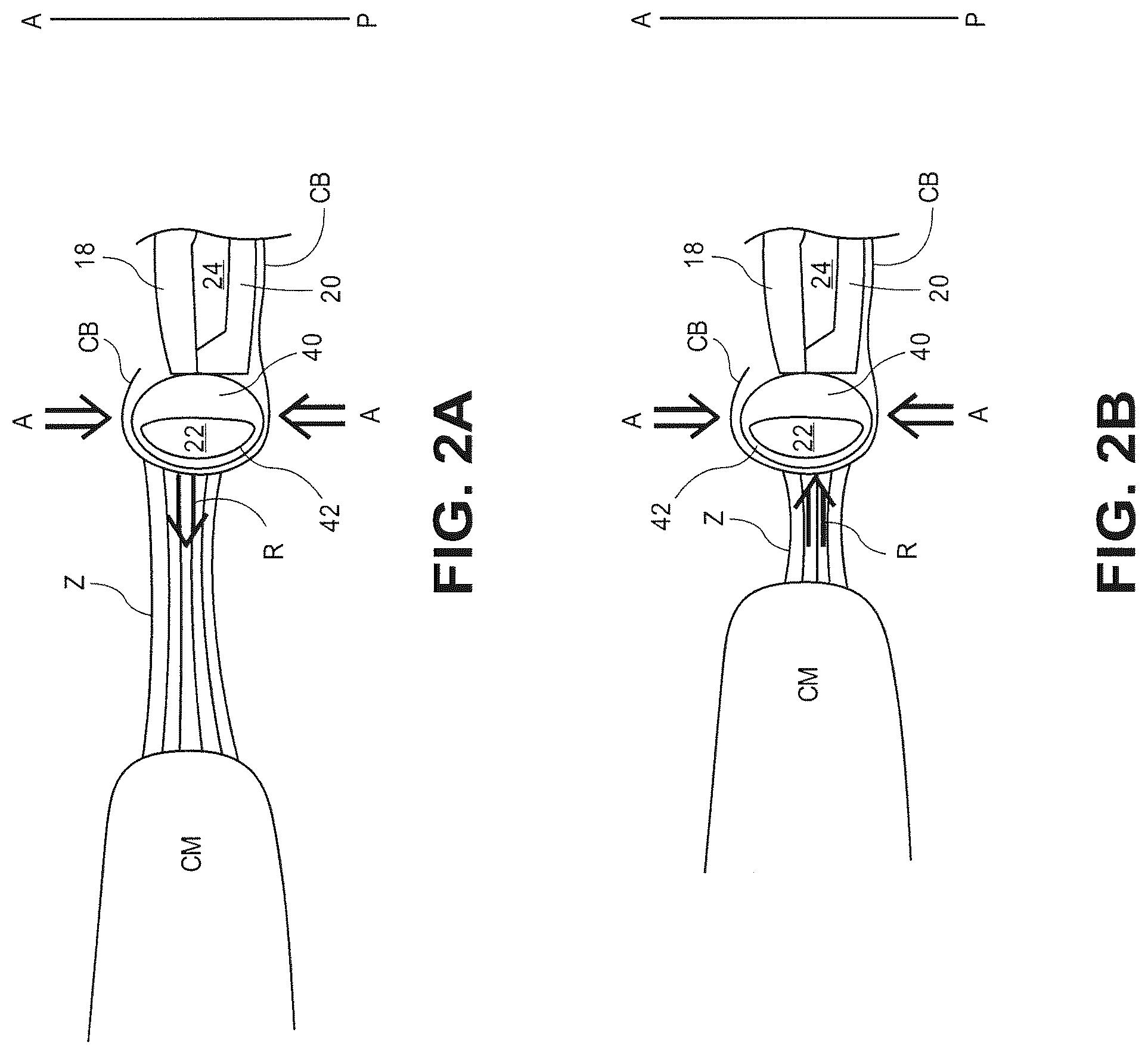 Patent US12611296 Figure 3 – Intraocular lens materials and components
