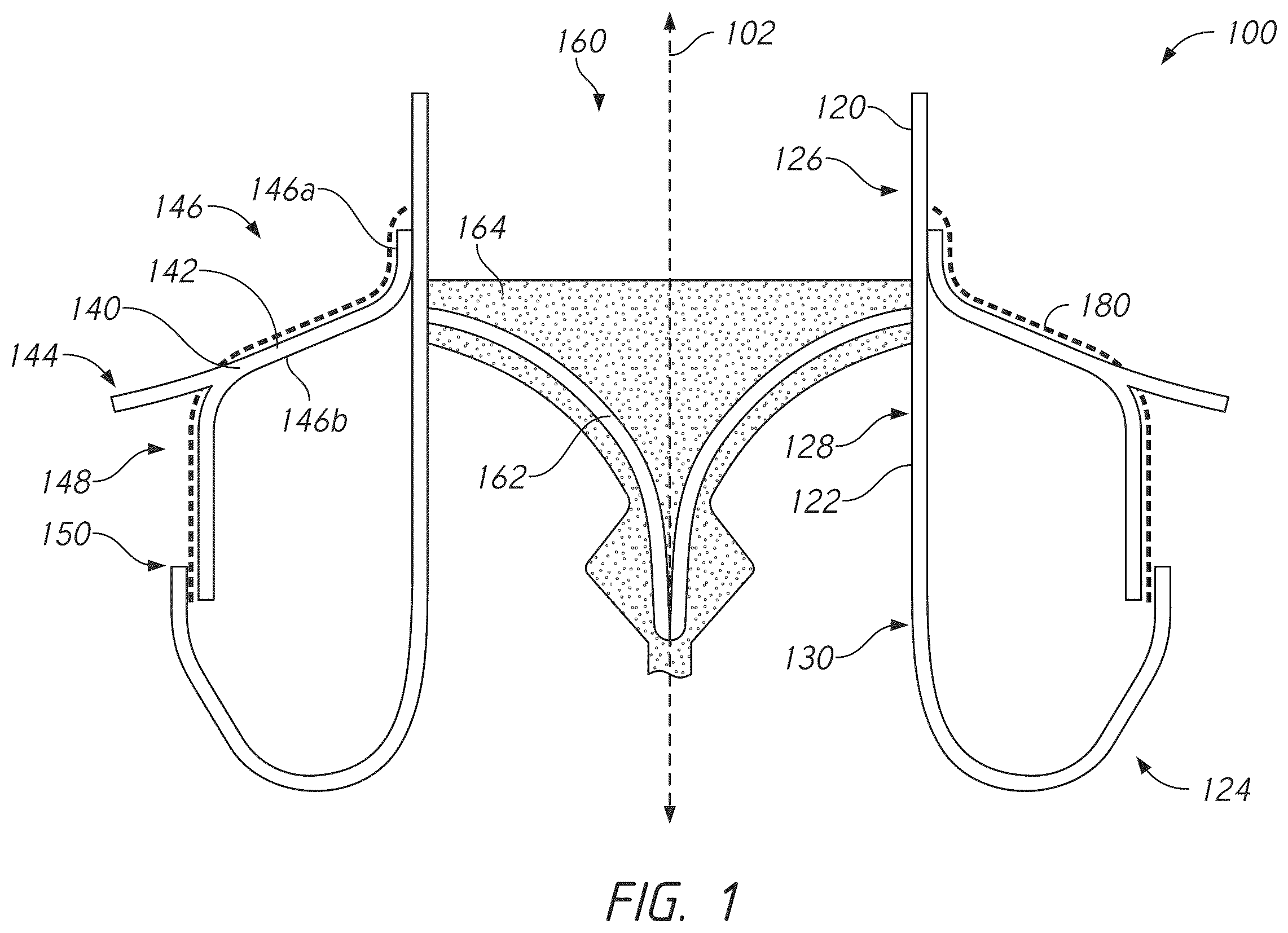 Patent US12611298 Figure 1 – Multi-portion replacement heart valve prosthesis