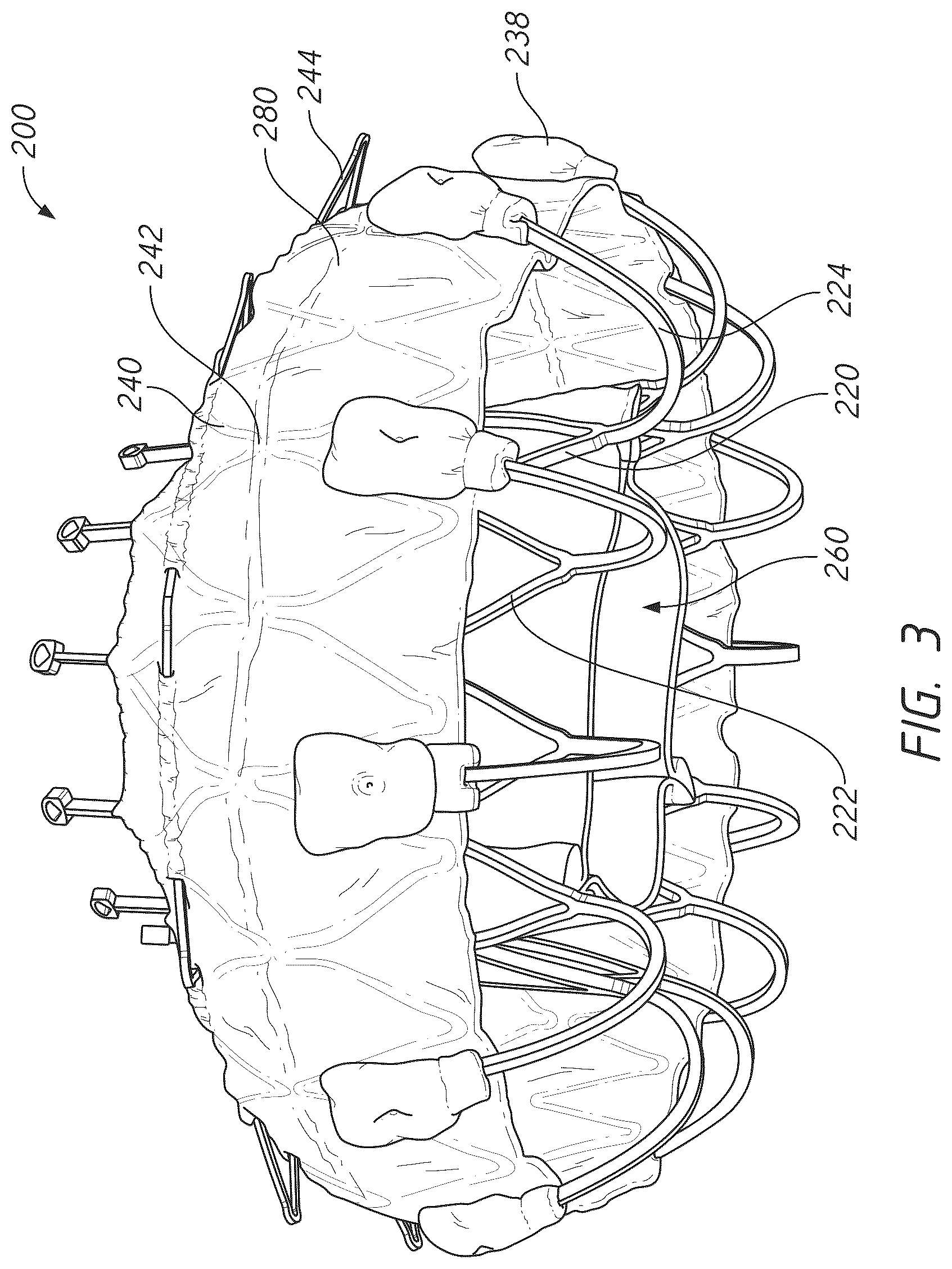 Patent US12611298 Figure 3 – Multi-portion replacement heart valve prosthesis
