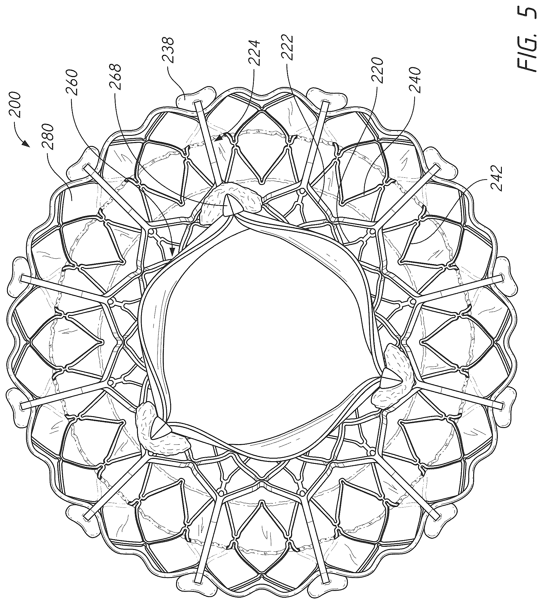 Patent US12611298 Figure 5 – Multi-portion replacement heart valve prosthesis