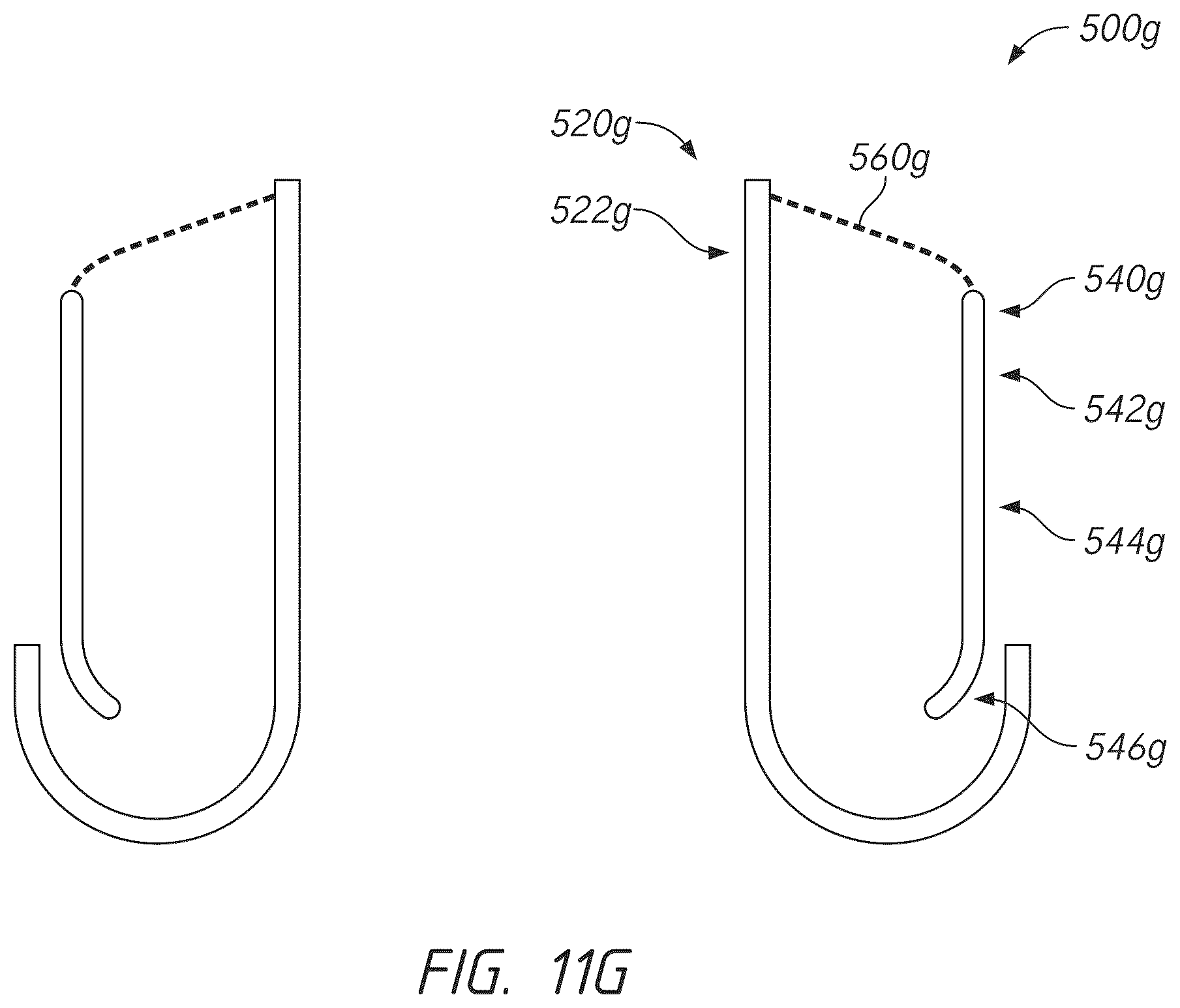 Patent US12611298 Figure 13 – Multi-portion replacement heart valve prosthesis