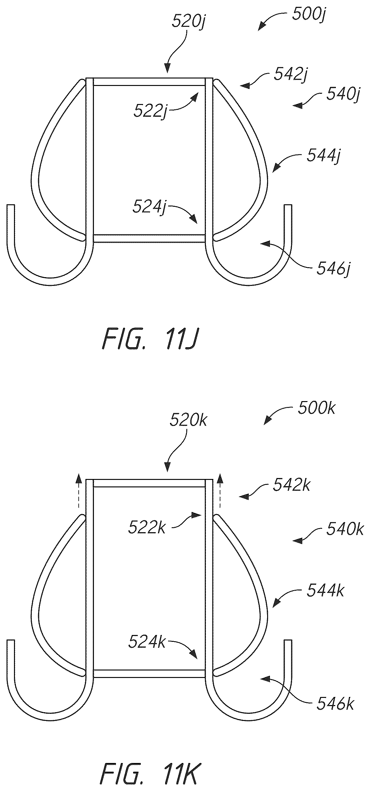 Patent US12611298 Figure 15 – Multi-portion replacement heart valve prosthesis