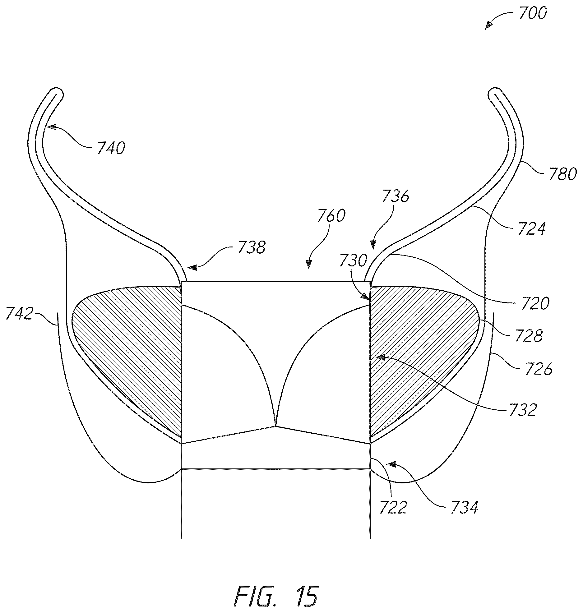 Patent US12611298 Figure 18 – Multi-portion replacement heart valve prosthesis