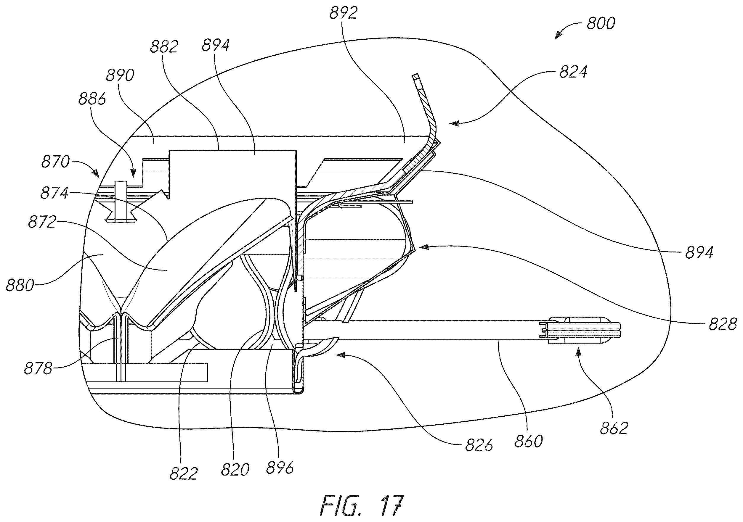 Patent US12611298 Figure 20 – Multi-portion replacement heart valve prosthesis