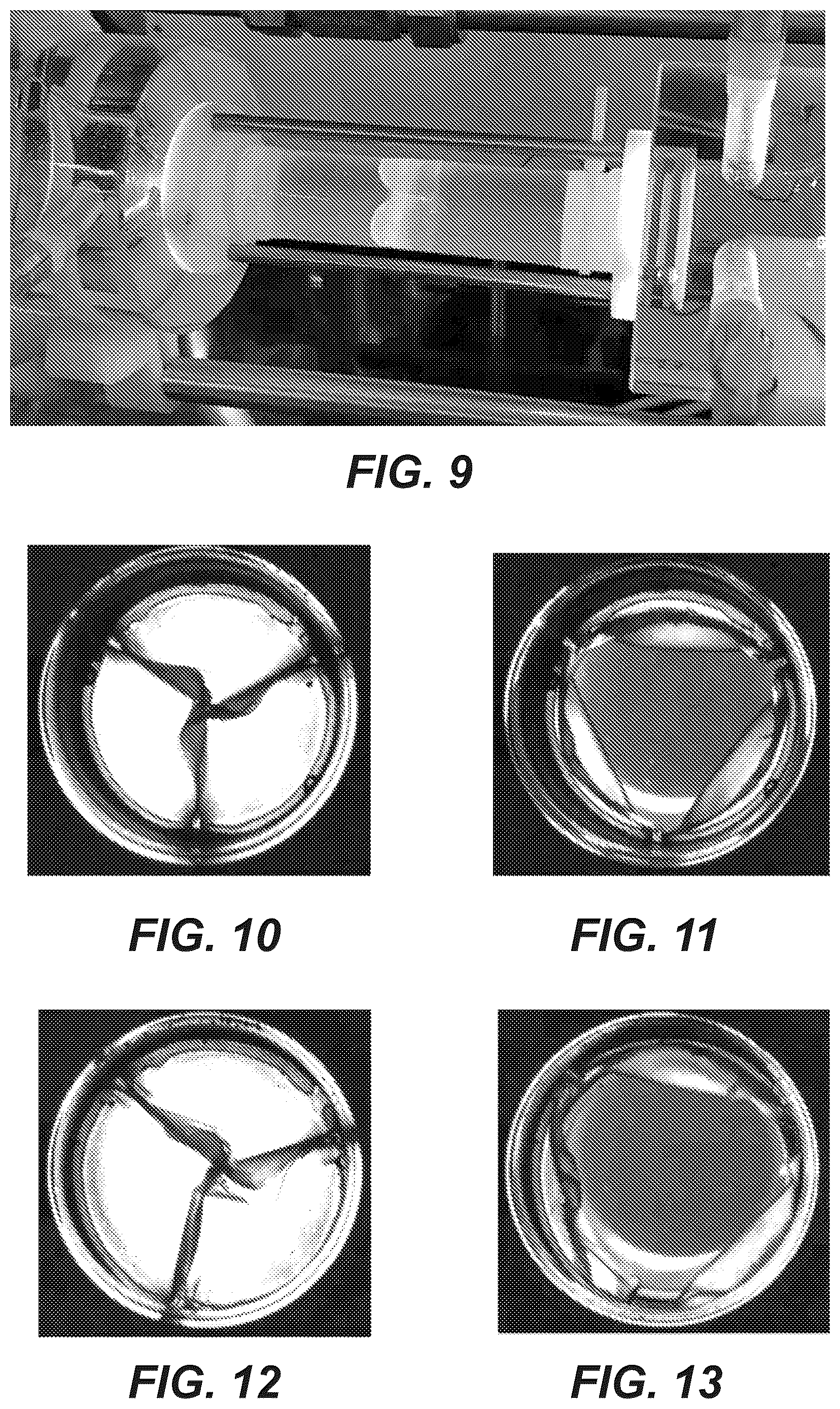 Patent US12611299 Figure 7 – Transcatheter dilatable biostable polymeric stented valved tube prosthesis