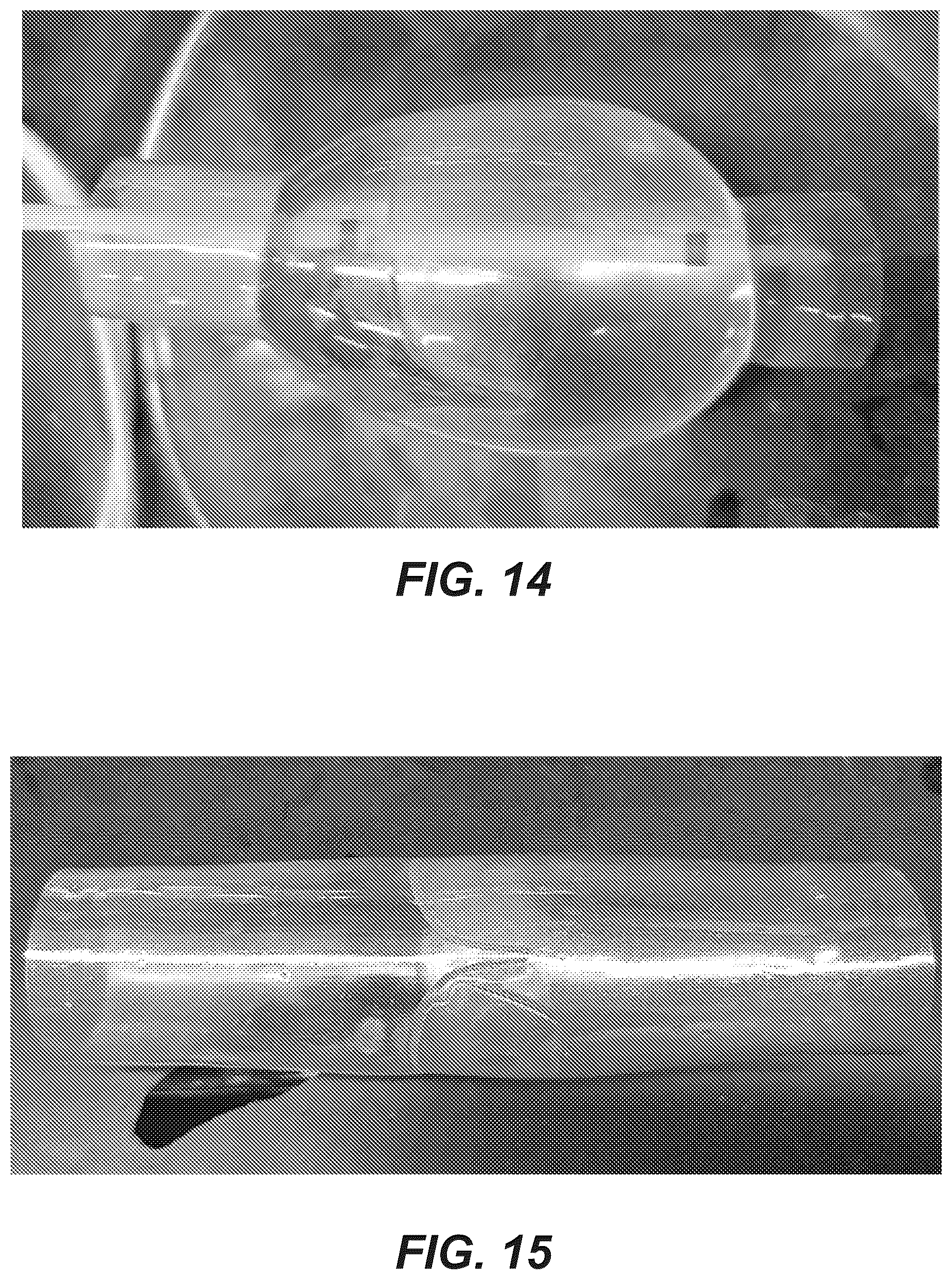 Patent US12611299 Figure 8 – Transcatheter dilatable biostable polymeric stented valved tube prosthesis