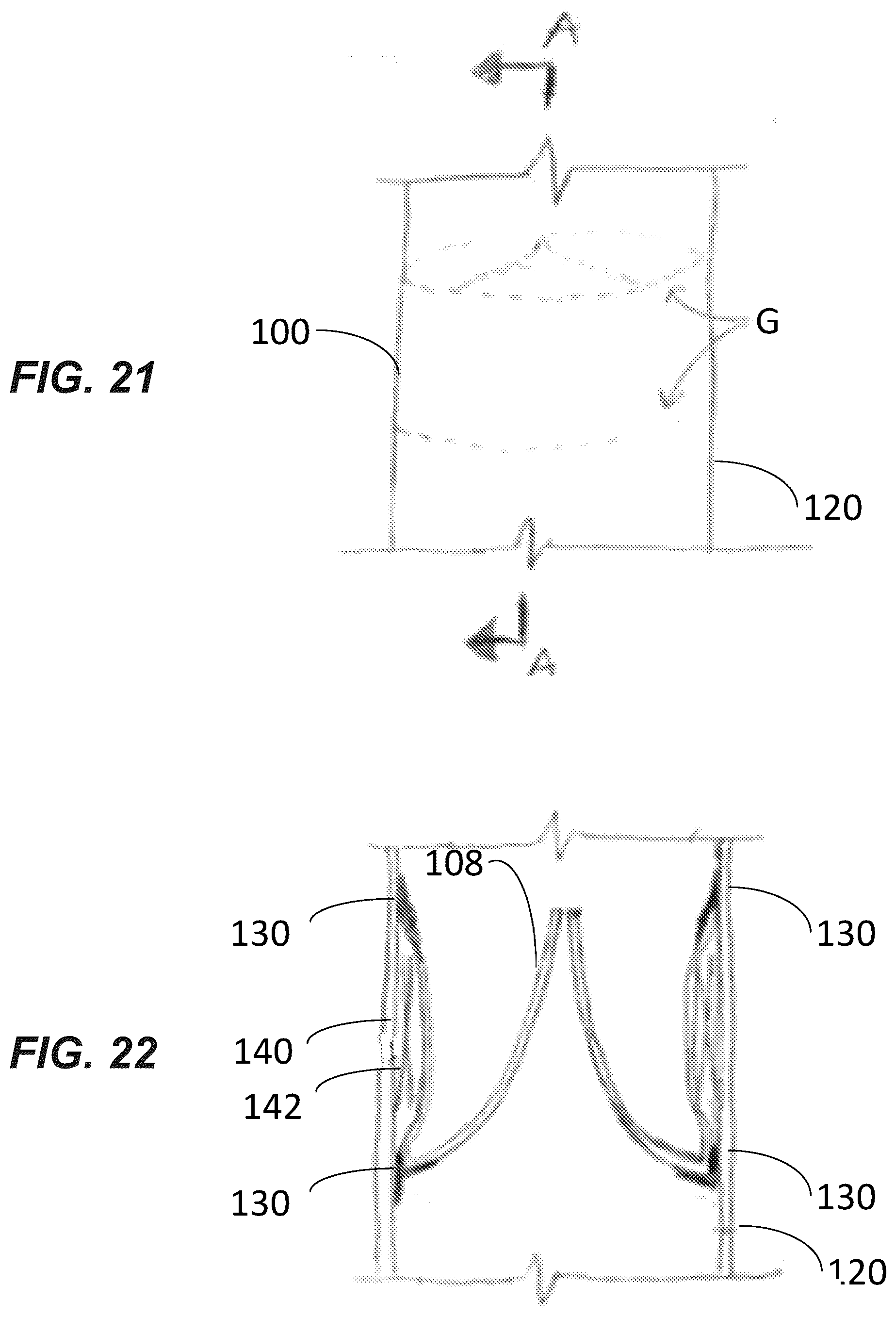 Patent US12611299 Figure 12 – Transcatheter dilatable biostable polymeric stented valved tube prosthesis