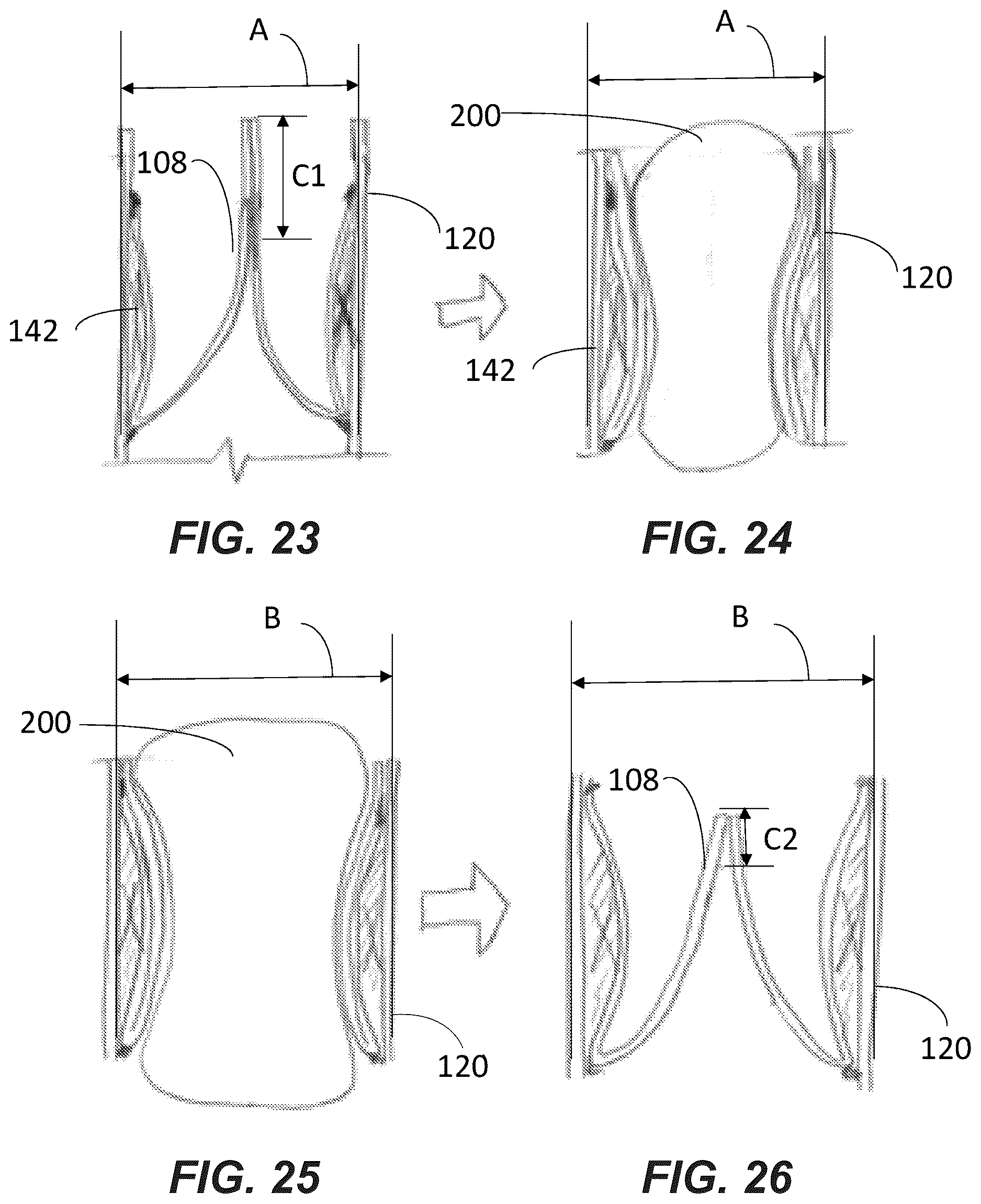 Patent US12611299 Figure 13 – Transcatheter dilatable biostable polymeric stented valved tube prosthesis