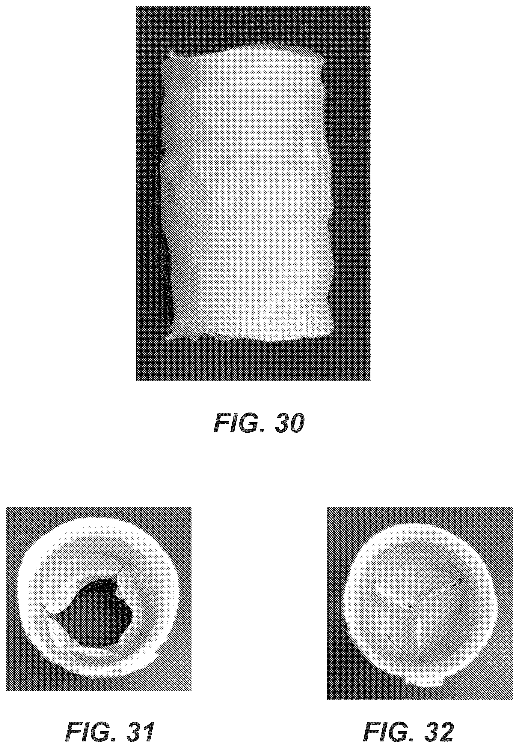 Patent US12611299 Figure 16 – Transcatheter dilatable biostable polymeric stented valved tube prosthesis