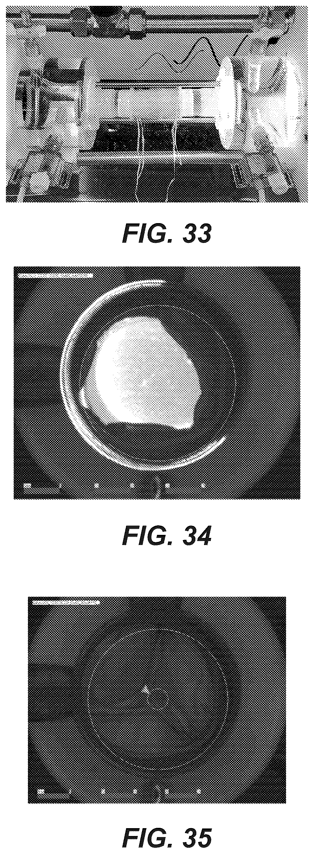 Patent US12611299 Figure 17 – Transcatheter dilatable biostable polymeric stented valved tube prosthesis