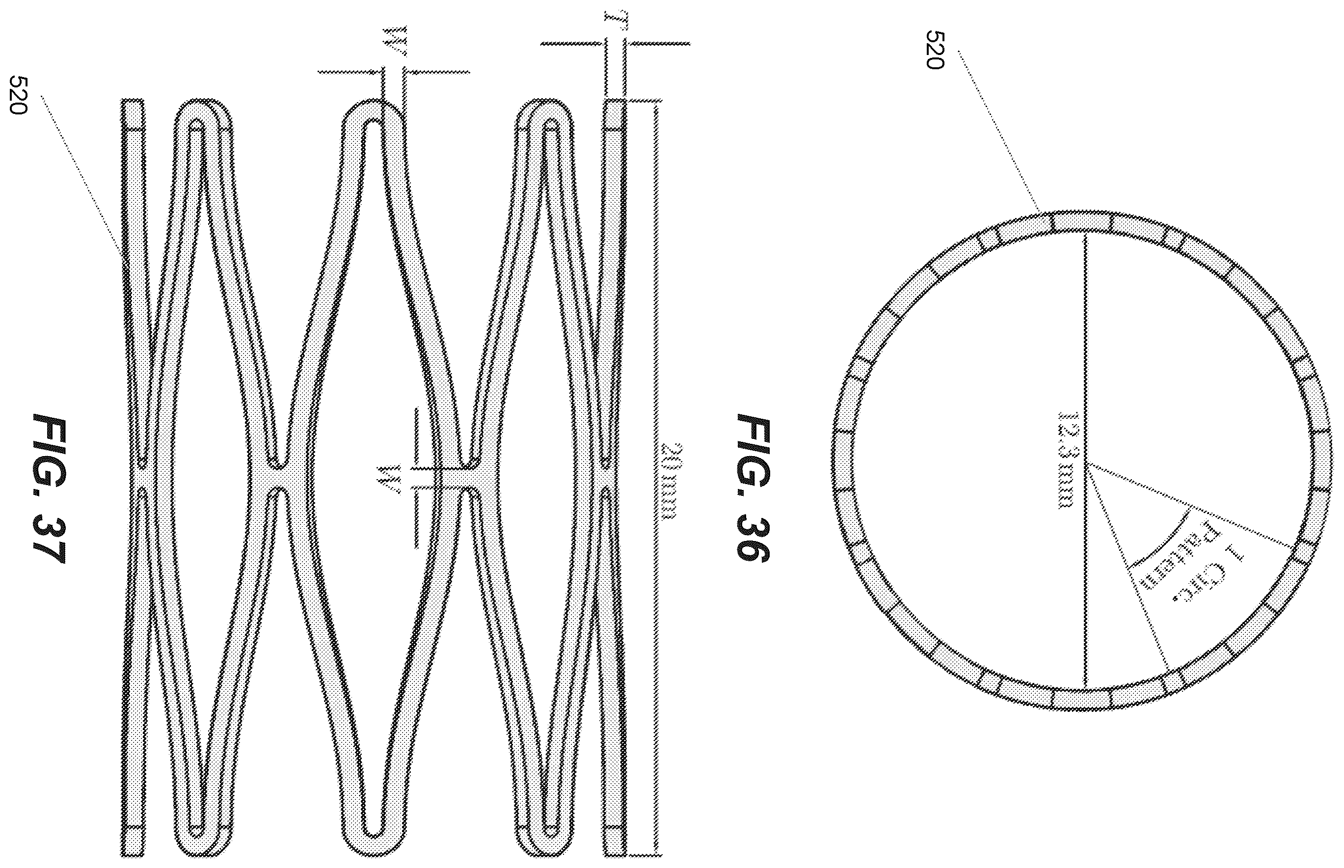 Patent US12611299 Figure 18 – Transcatheter dilatable biostable polymeric stented valved tube prosthesis