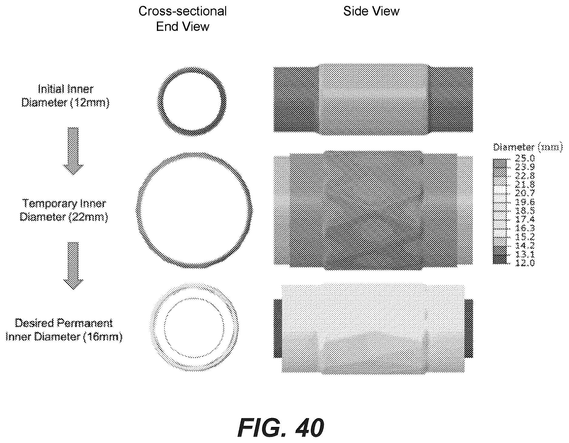 Patent US12611299 Figure 20 – Transcatheter dilatable biostable polymeric stented valved tube prosthesis