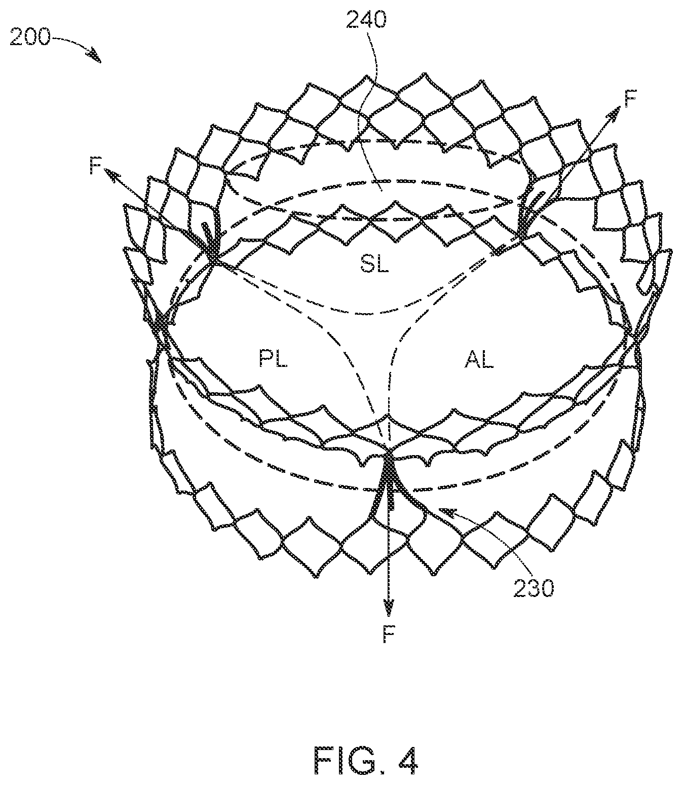 Patent US12611300 Figure 4 – Transcatheter prosthetic atrioventricular valve