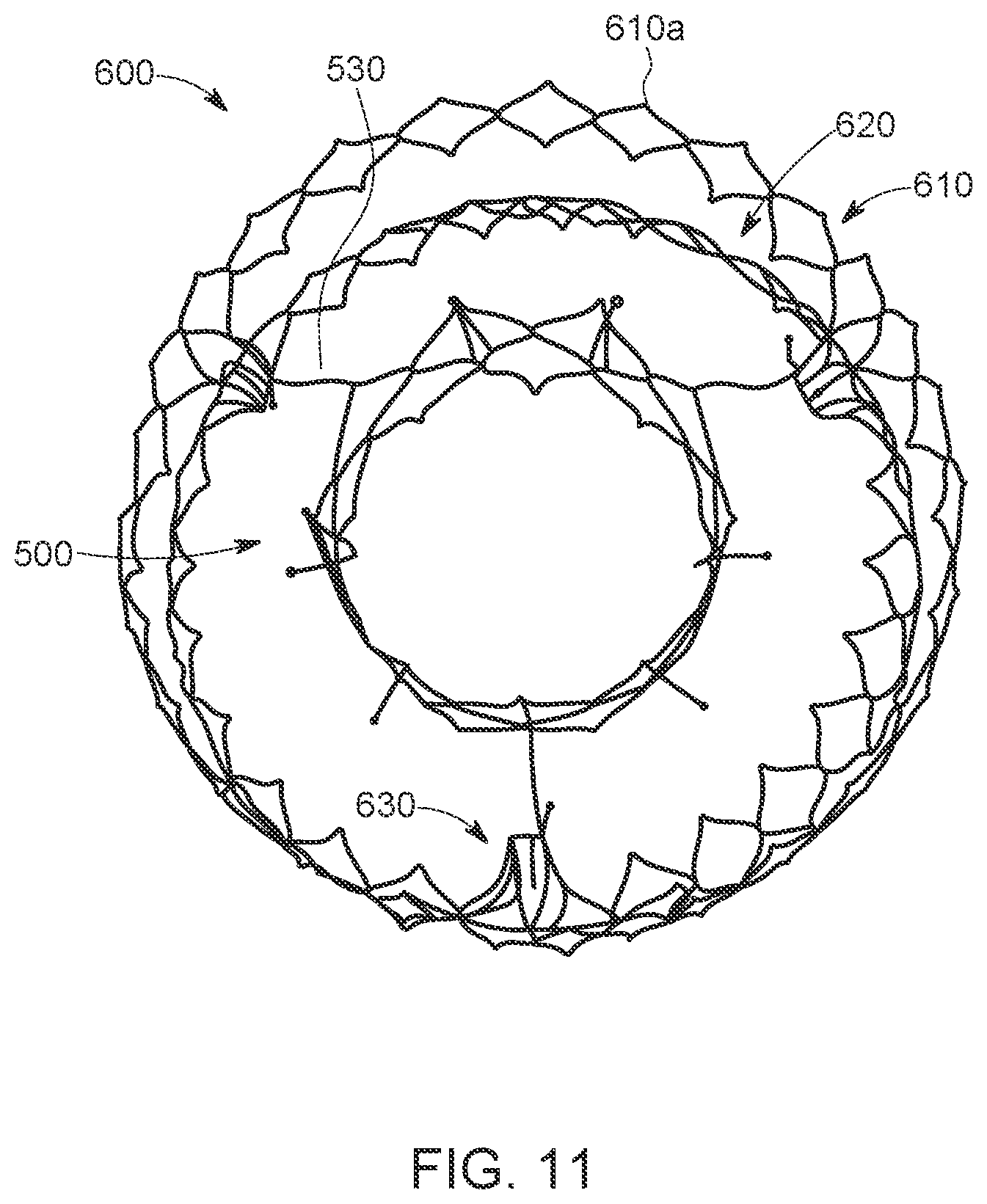 Patent US12611300 Figure 11 – Transcatheter prosthetic atrioventricular valve