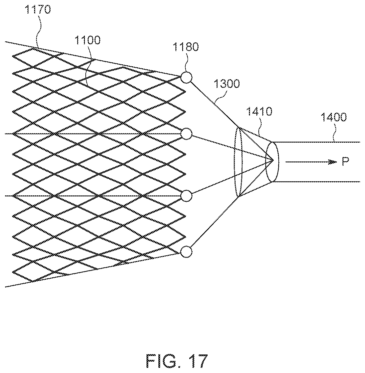 Patent US12611300 Figure 17 – Transcatheter prosthetic atrioventricular valve