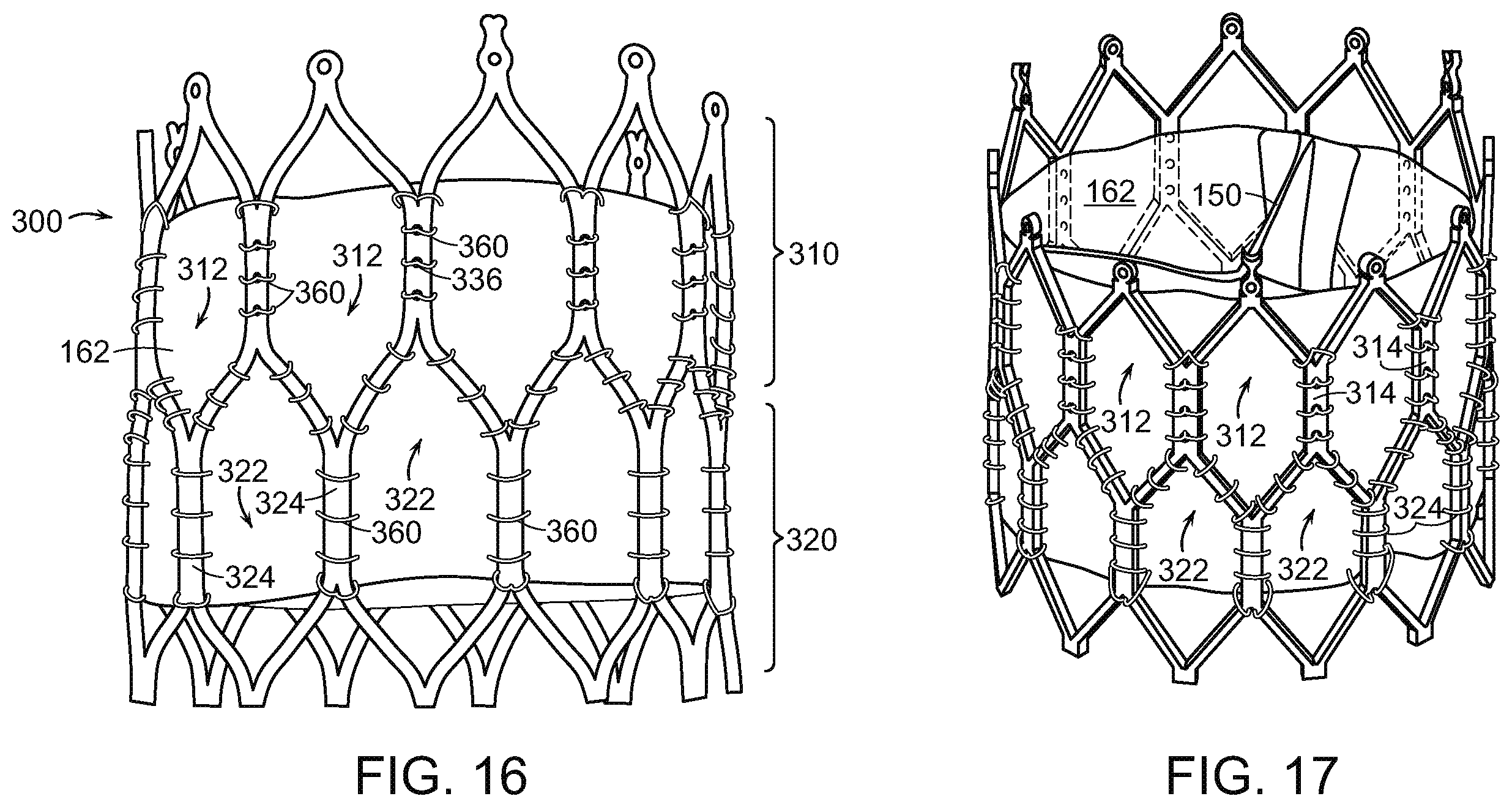 Patent US12611302 Figure 12 – Prosthetic heart valve device and associated systems and methods