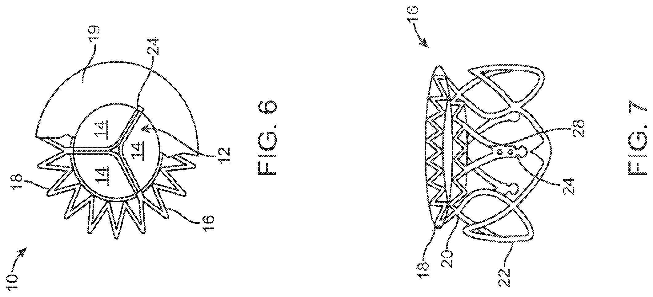 Patent US12611303 Figure 8 – Transcatheter mitral valve prosthesis
