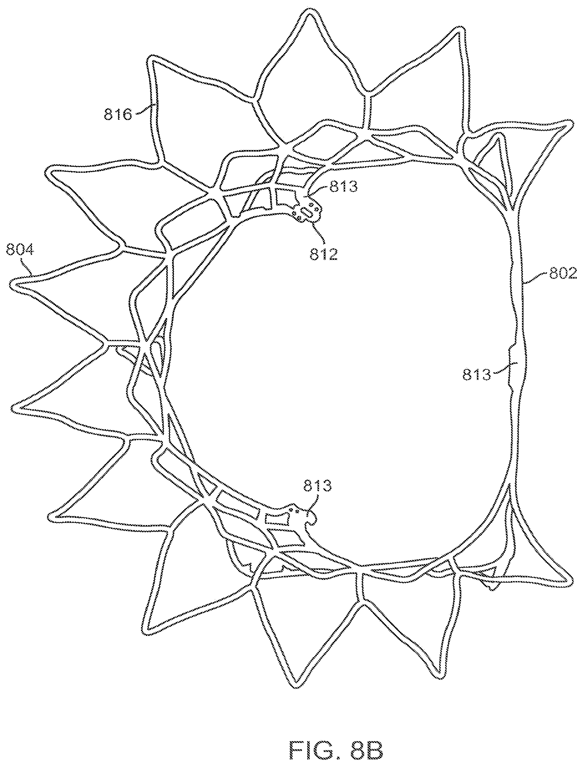 Patent US12611303 Figure 10 – Transcatheter mitral valve prosthesis
