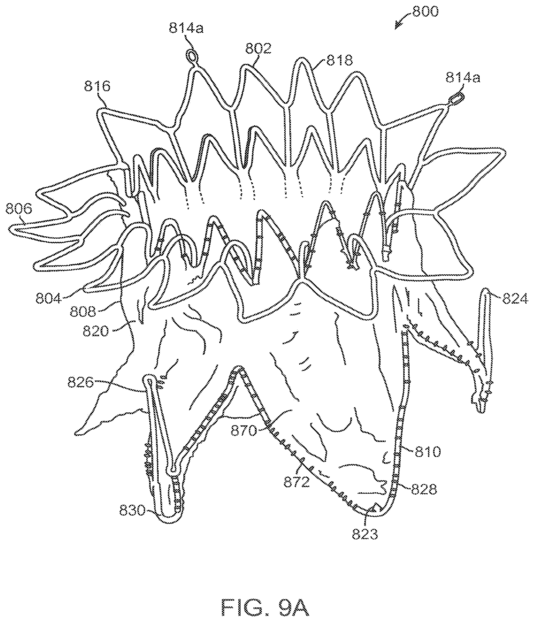 Patent US12611303 Figure 11 – Transcatheter mitral valve prosthesis