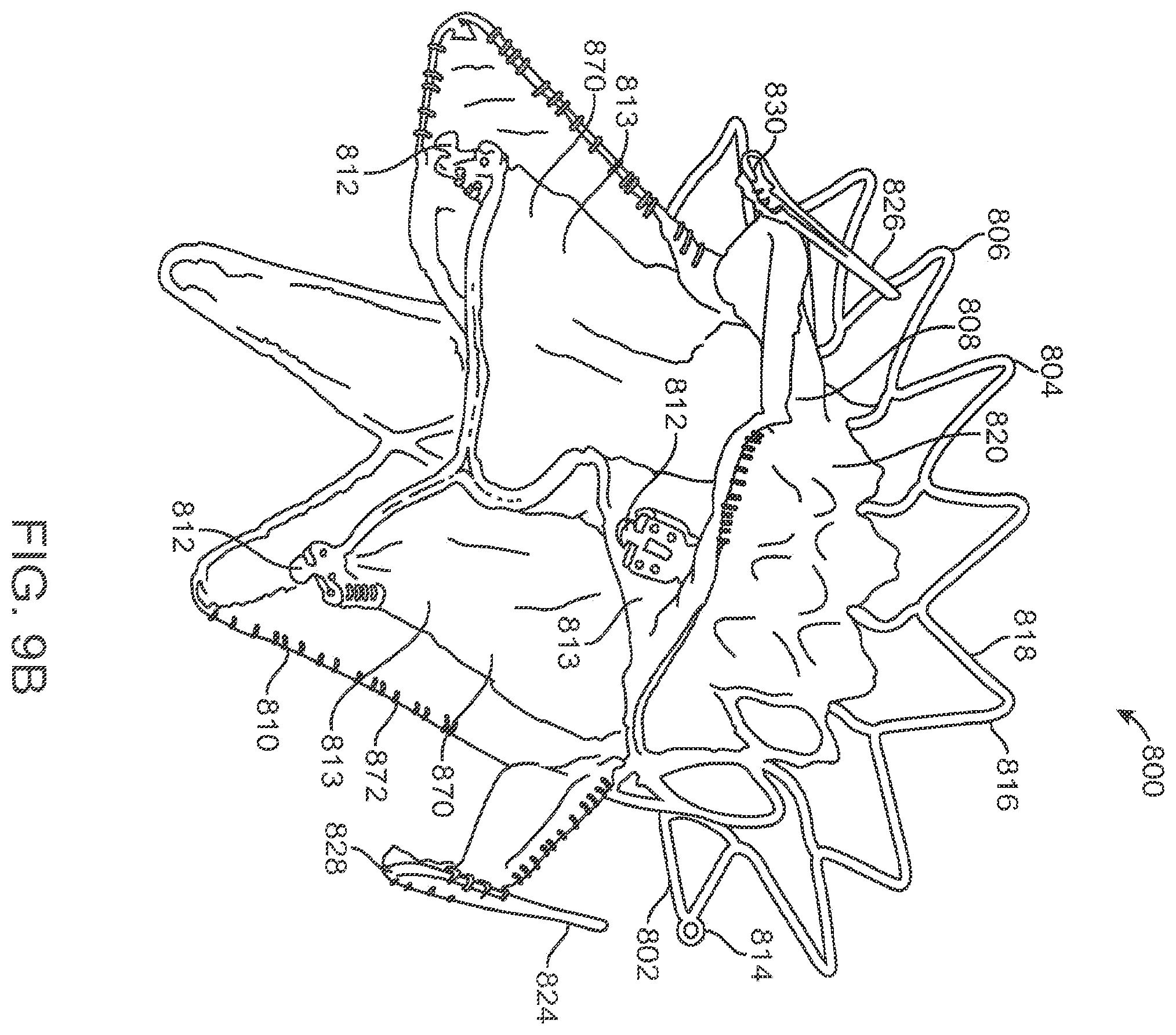 Patent US12611303 Figure 12 – Transcatheter mitral valve prosthesis