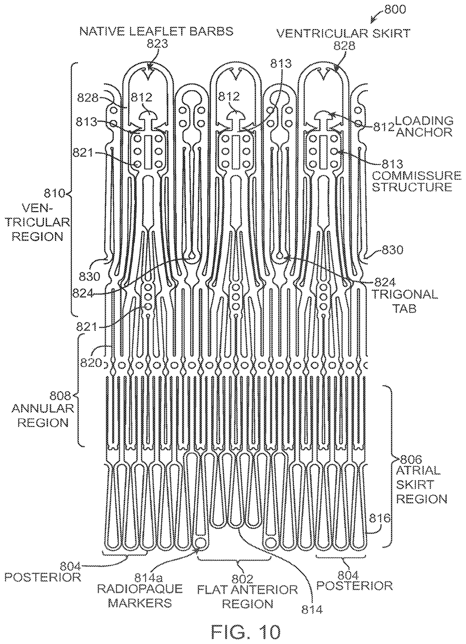 Patent US12611303 Figure 13 – Transcatheter mitral valve prosthesis