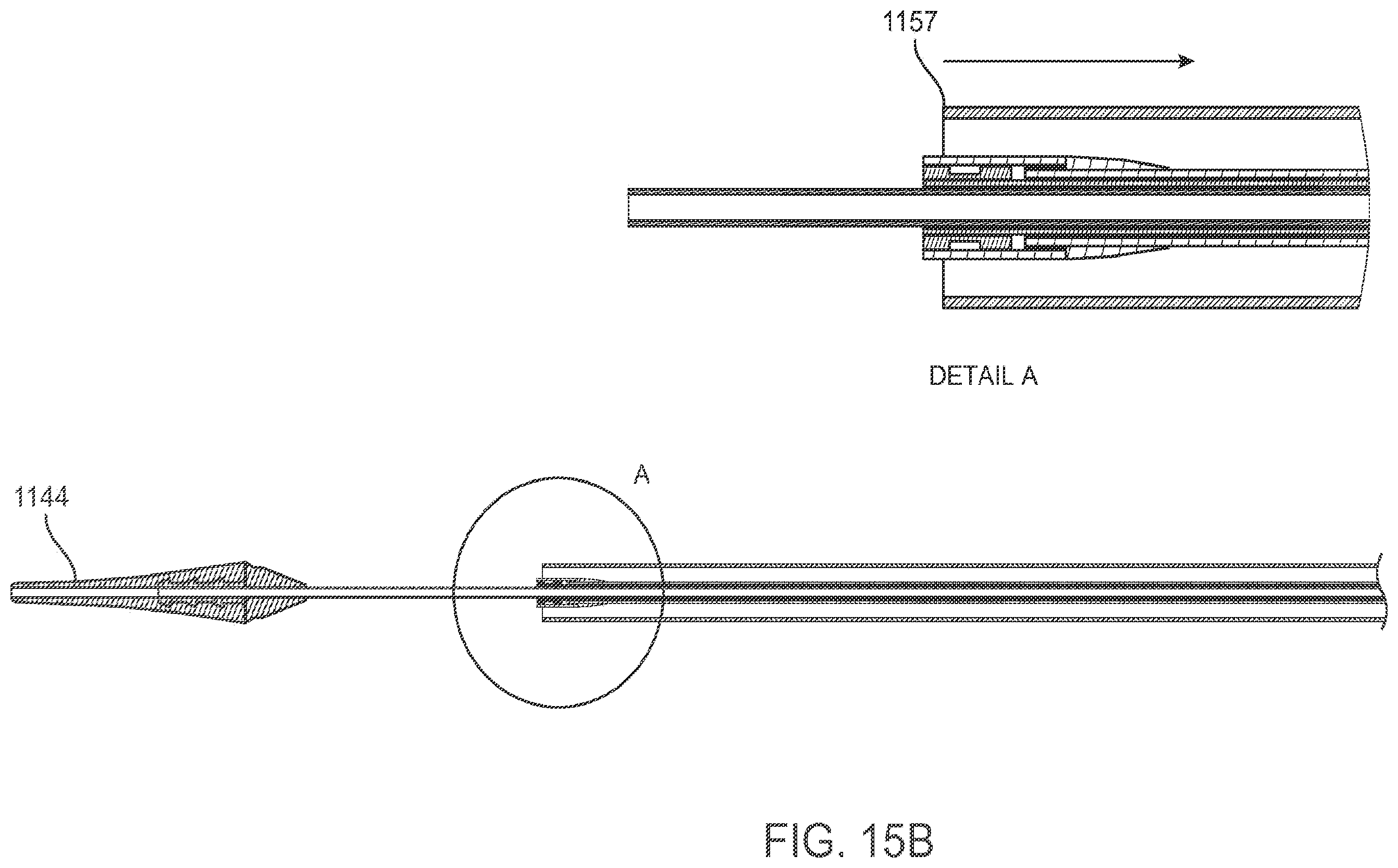 Patent US12611303 Figure 19 – Transcatheter mitral valve prosthesis