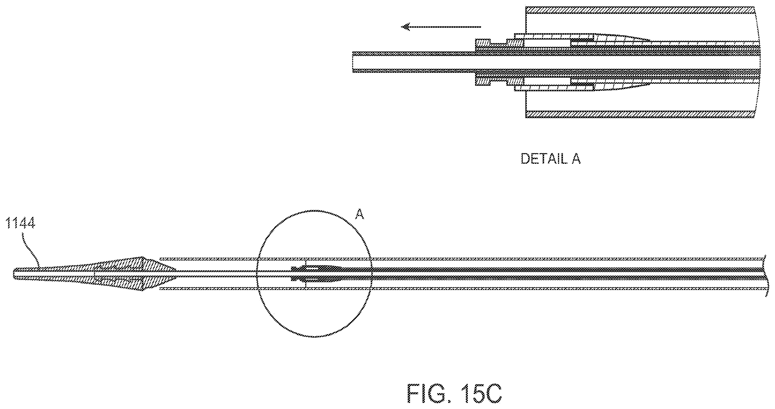 Patent US12611303 Figure 20 – Transcatheter mitral valve prosthesis