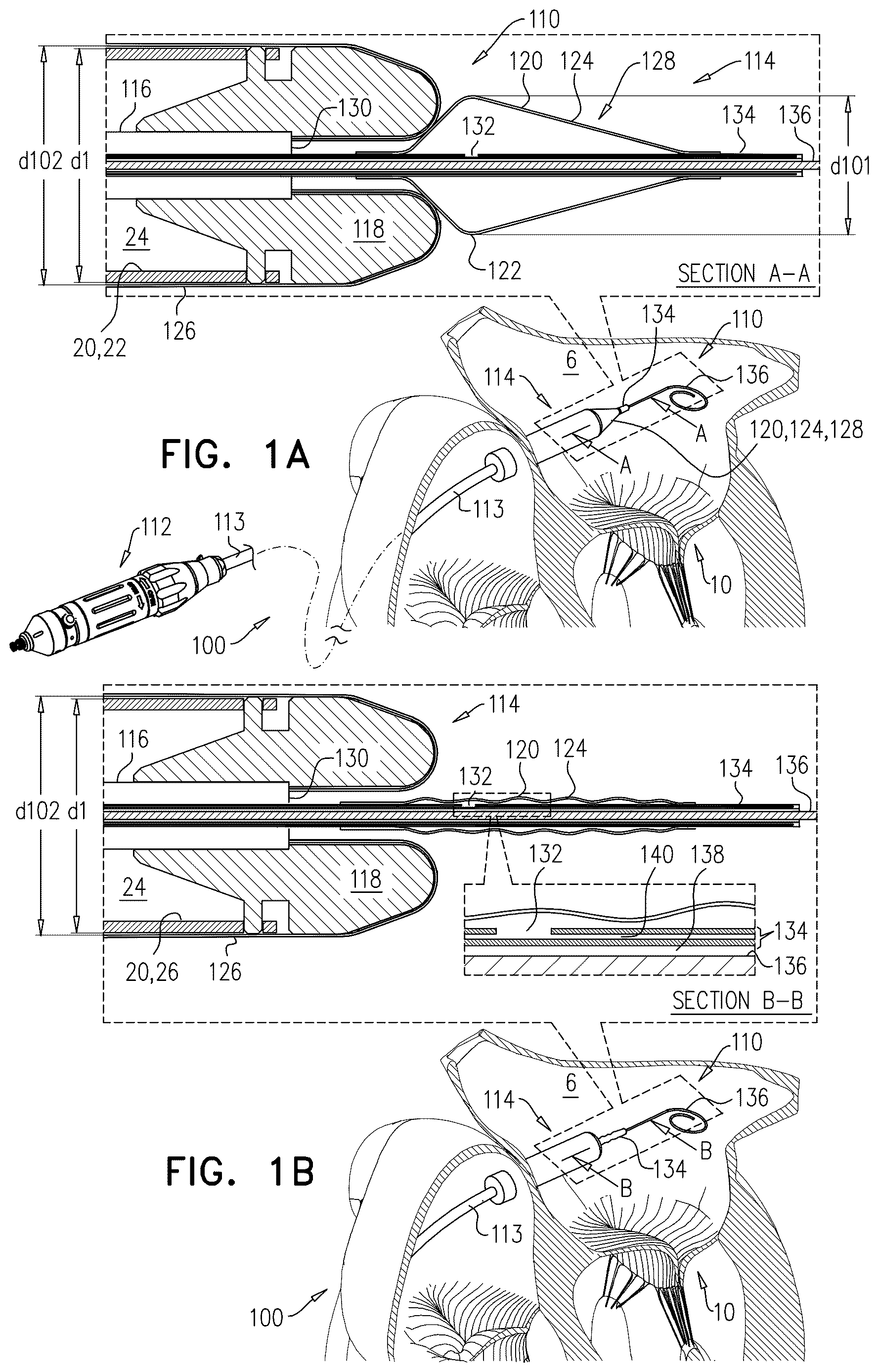 Patent US12611305 — Minimally-invasive delivery systems — Figure 1