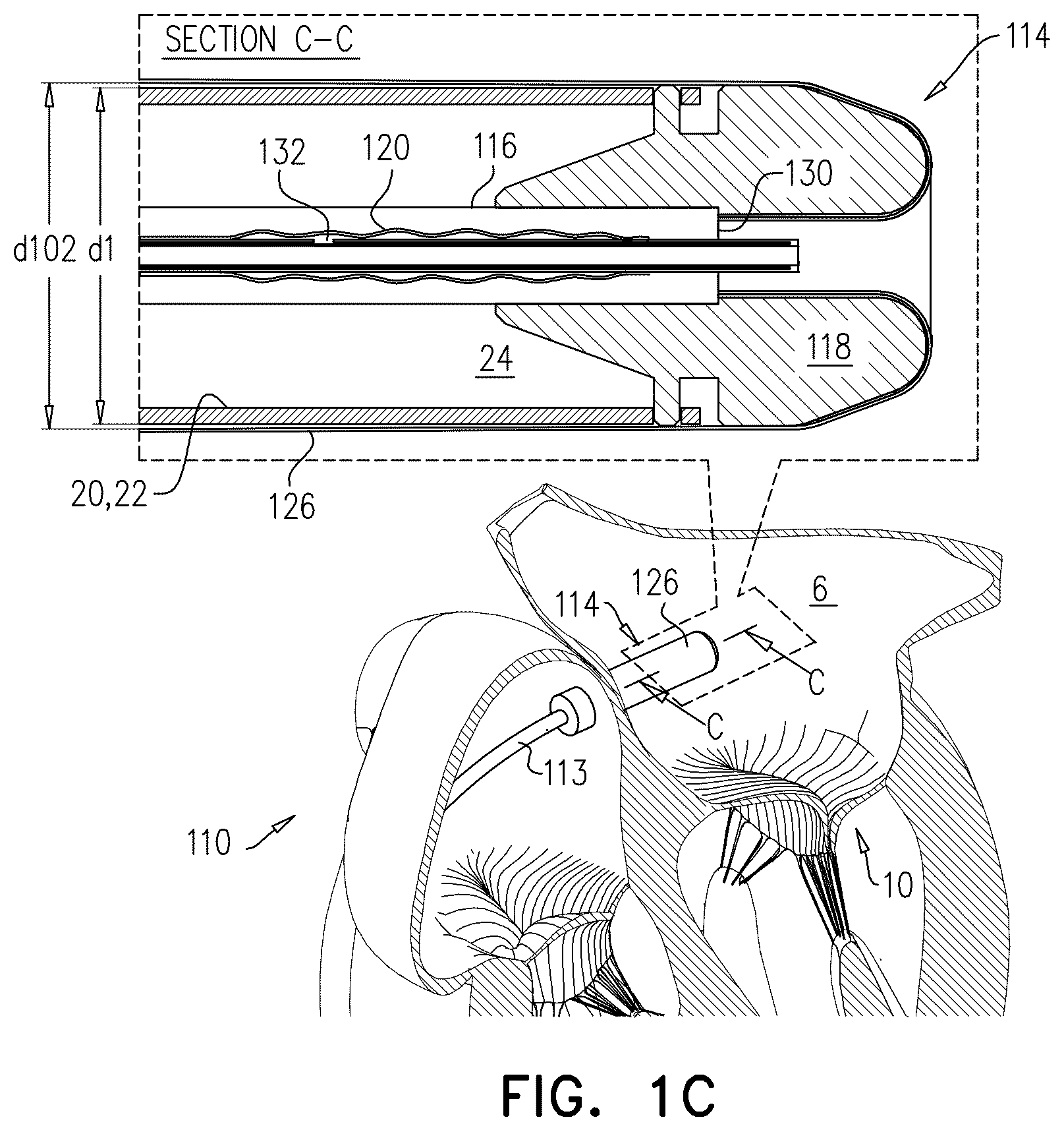 Patent US12611305 Figure 2 – Minimally-invasive delivery systems