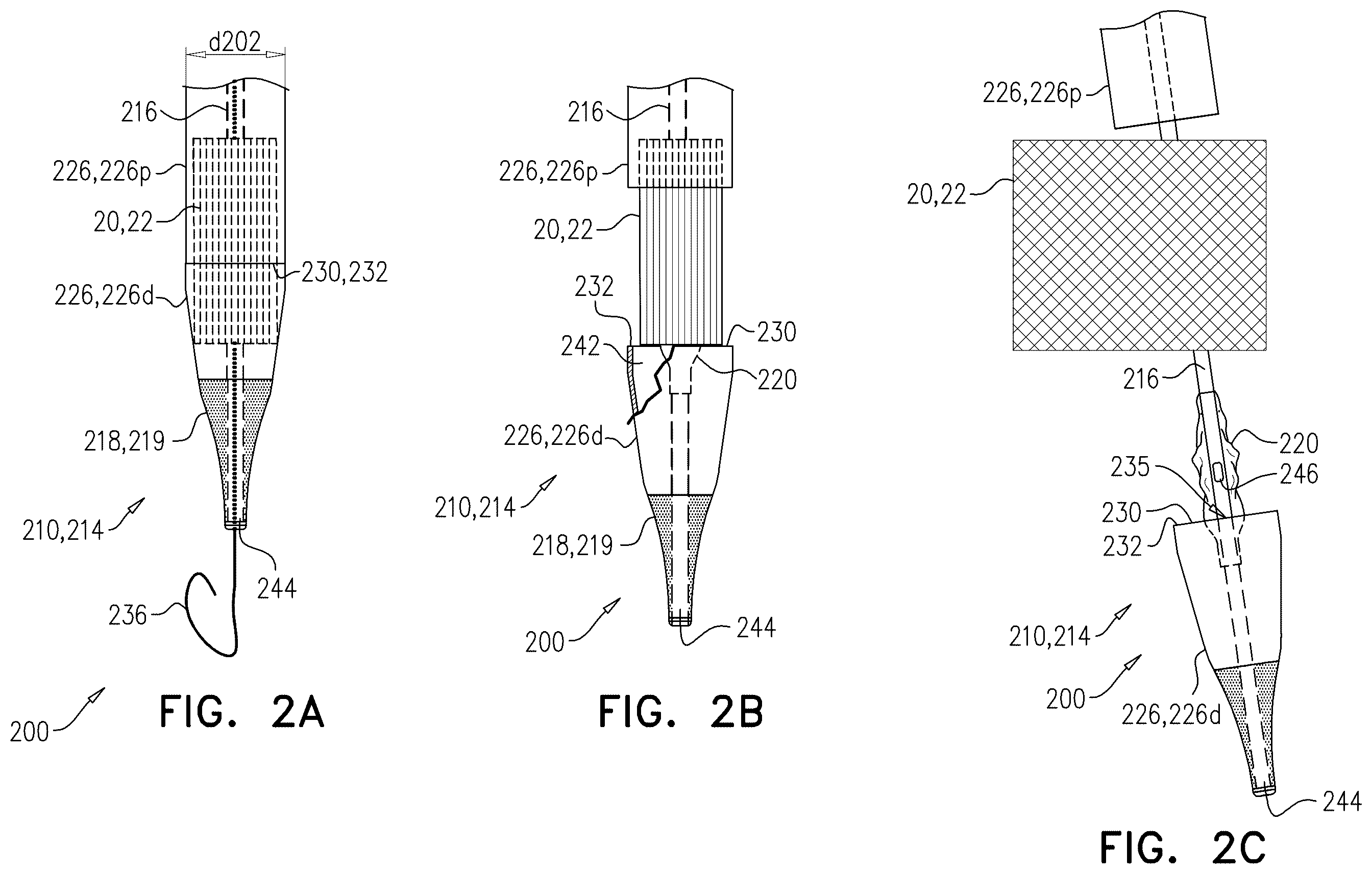 Patent US12611305 Figure 5 – Minimally-invasive delivery systems