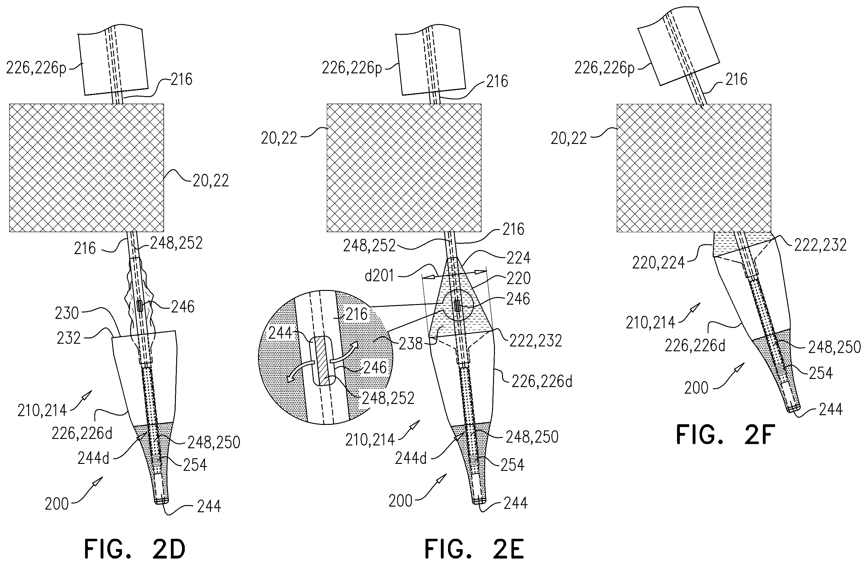 Patent US12611305 Figure 6 – Minimally-invasive delivery systems