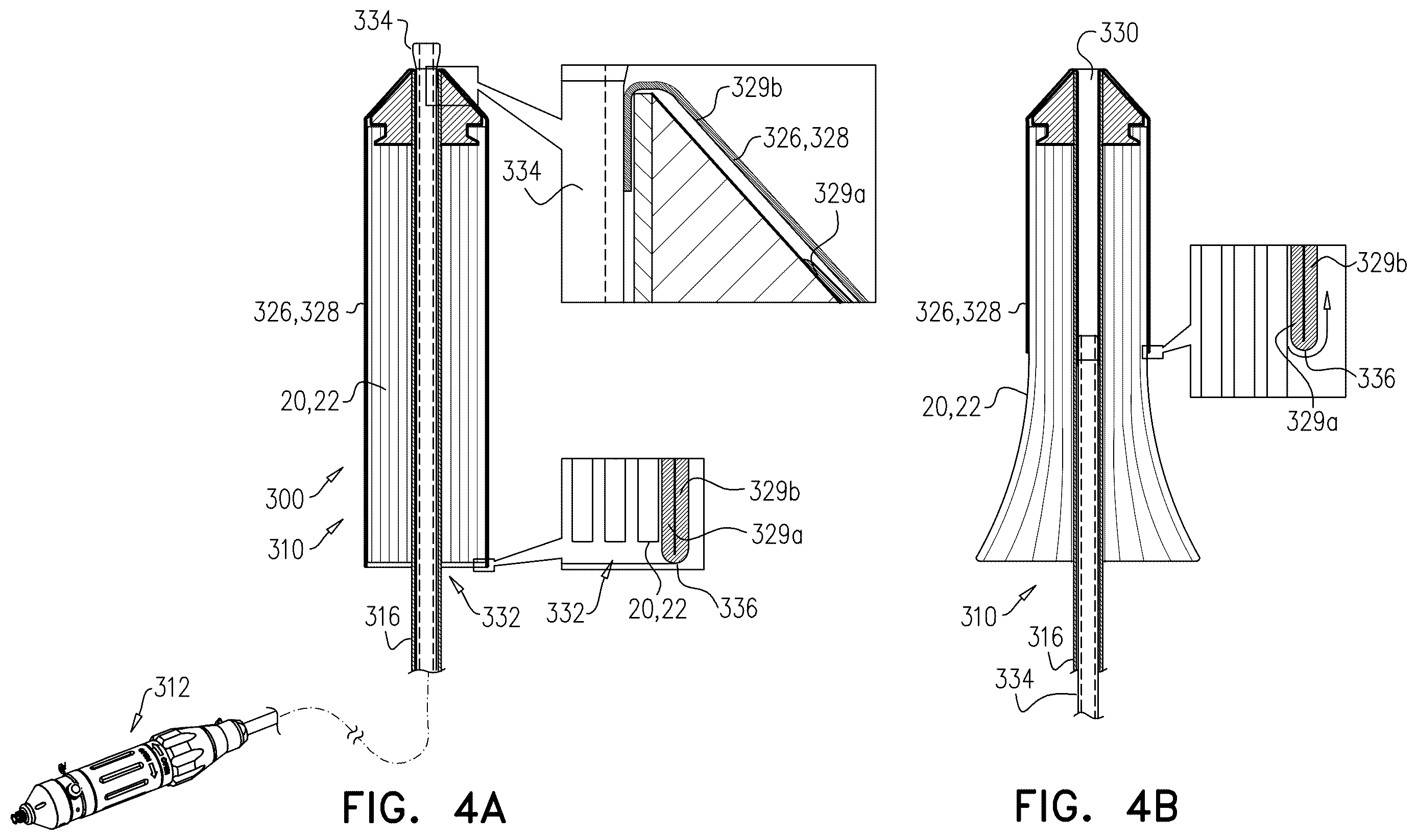Patent US12611305 Figure 8 – Minimally-invasive delivery systems