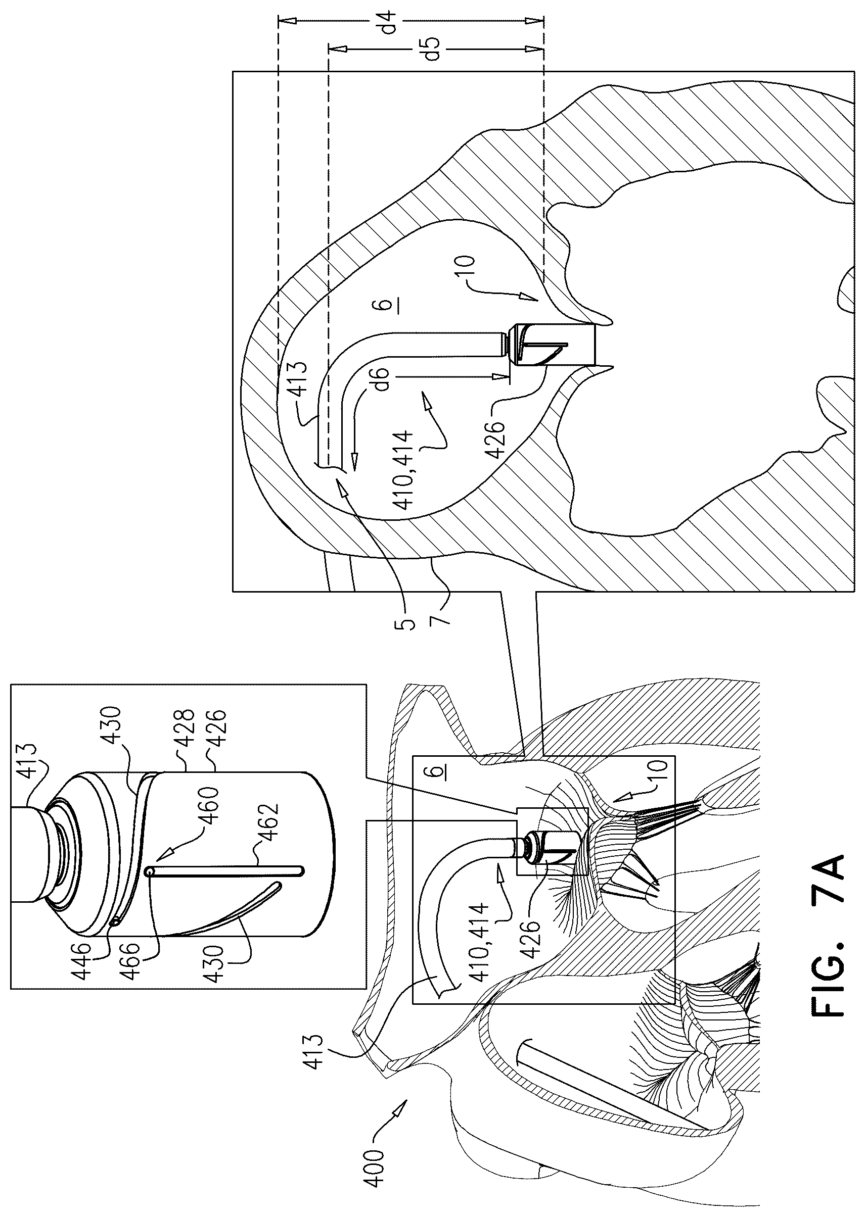 Patent US12611305 Figure 13 – Minimally-invasive delivery systems