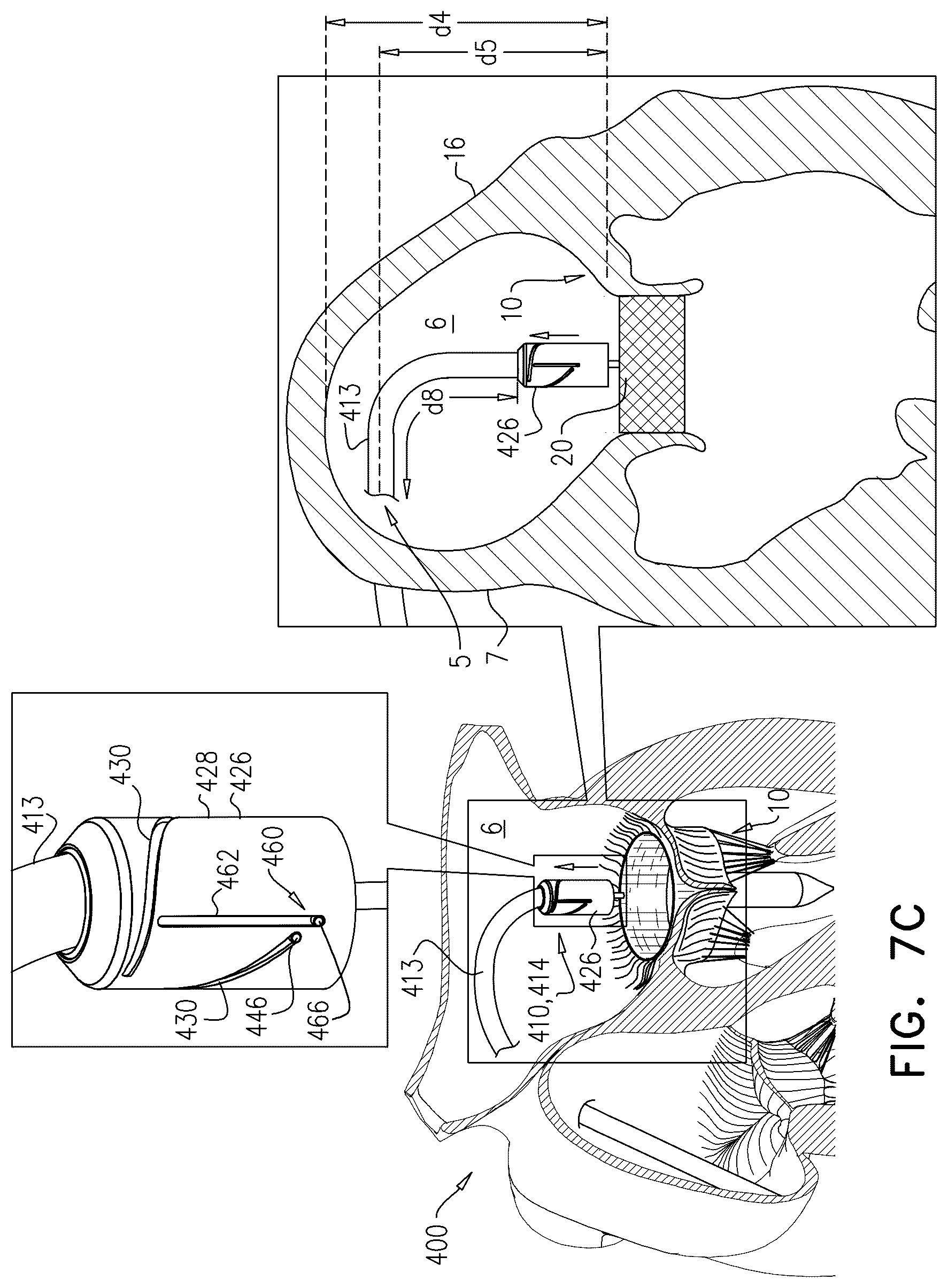 Patent US12611305 Figure 15 – Minimally-invasive delivery systems