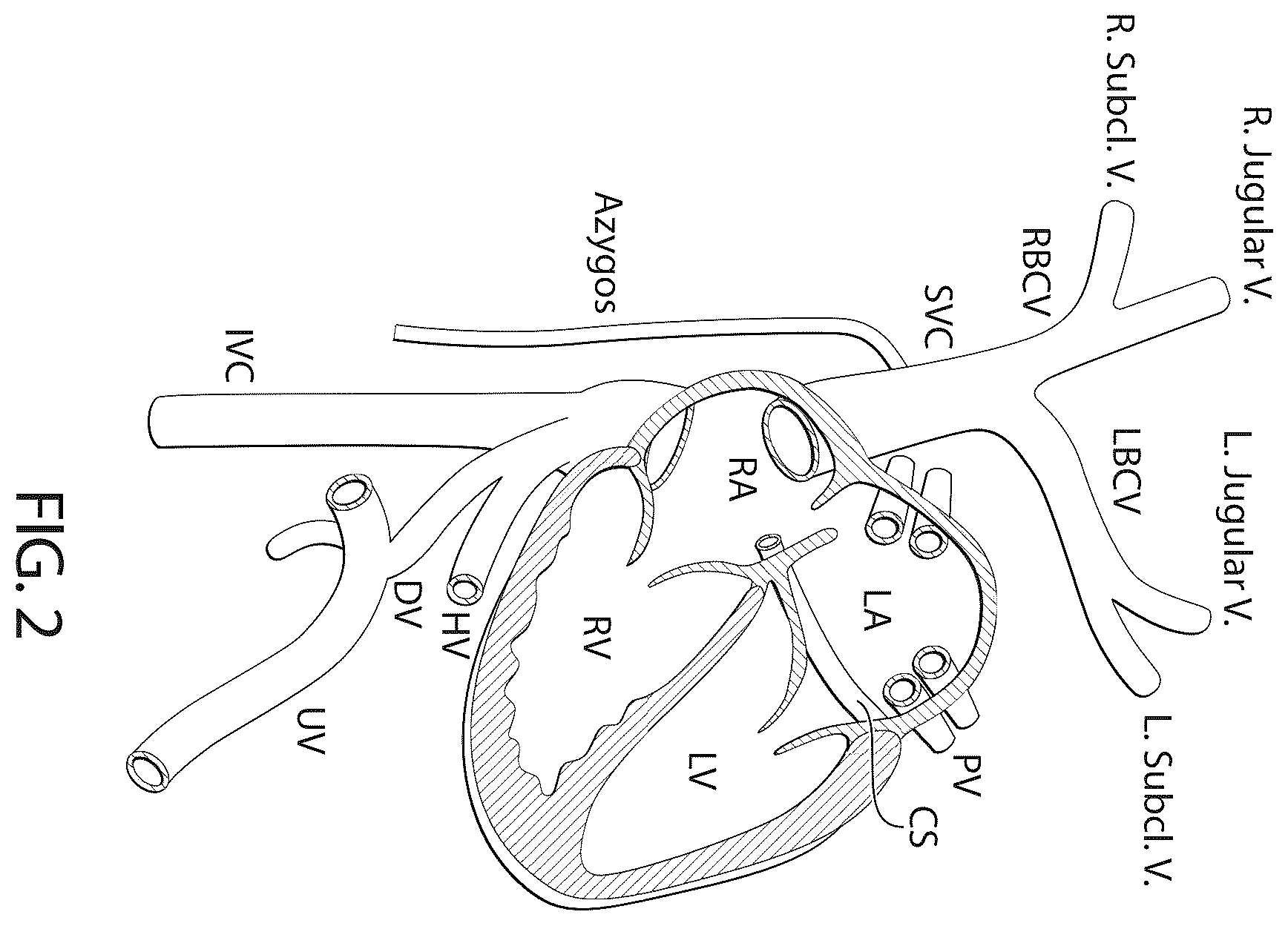 Patent US12611306 Figure 2 – Delivery systems and methods for prosthetic heart valve