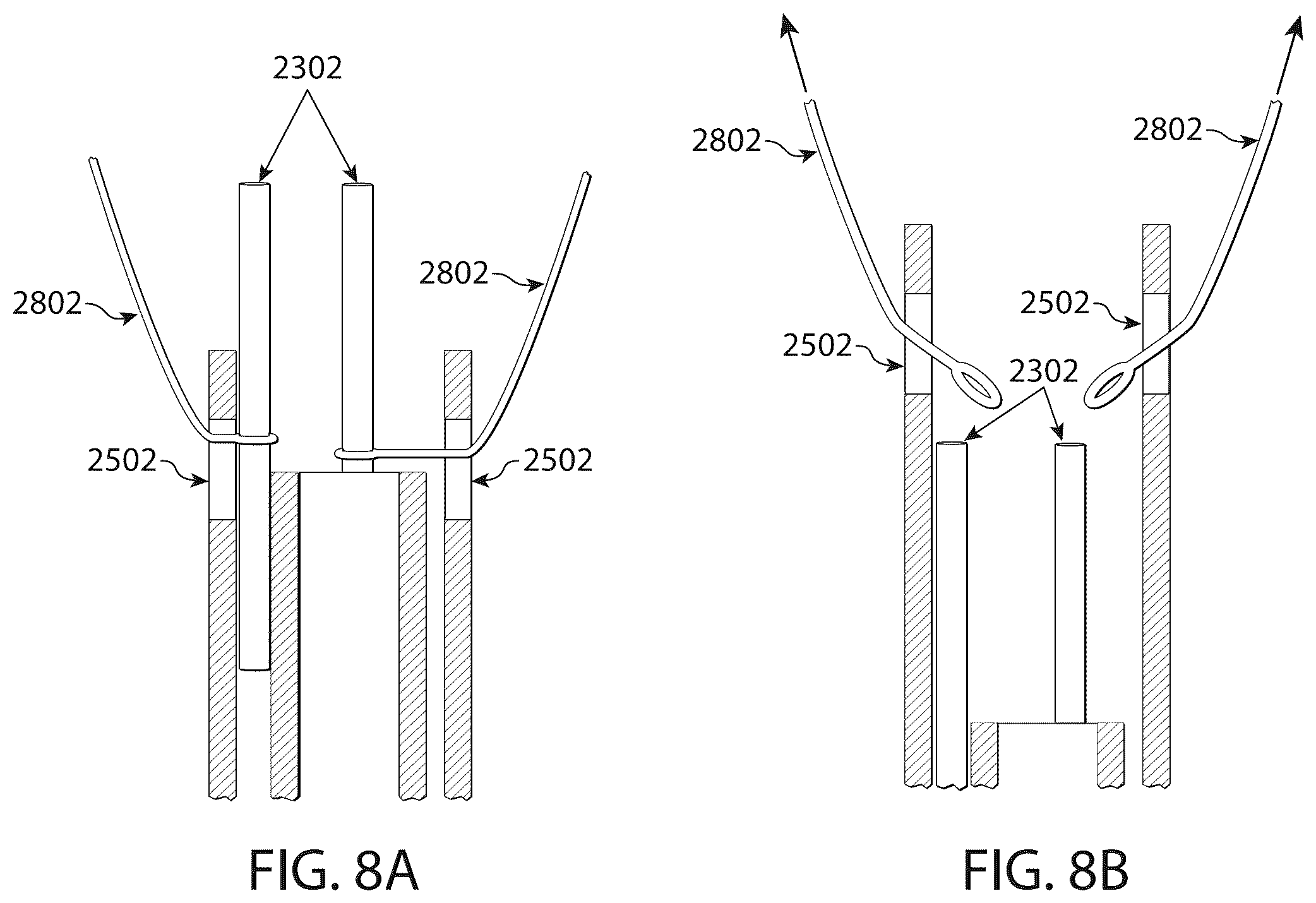 Patent US12611306 Figure 10 – Delivery systems and methods for prosthetic heart valve