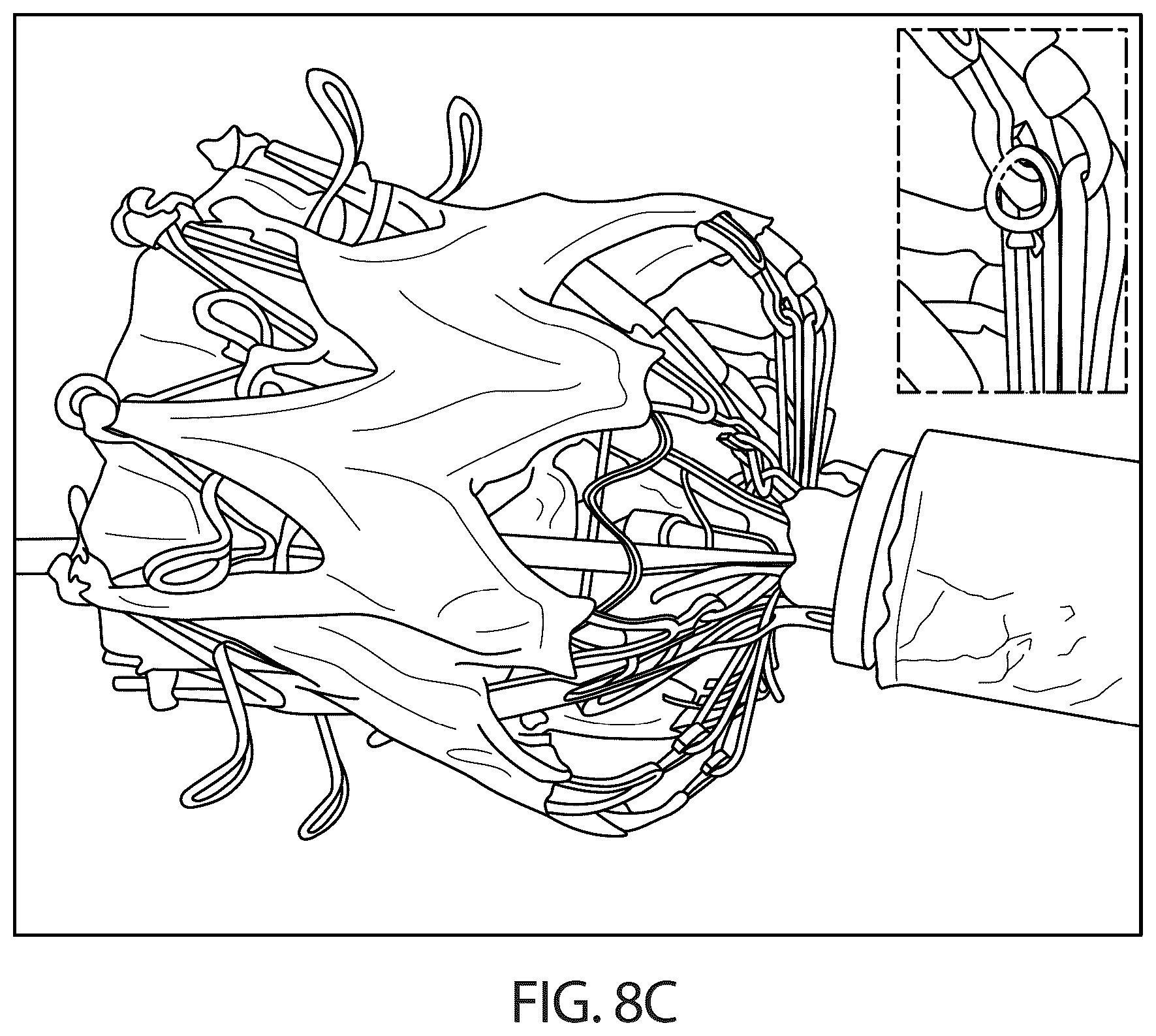 Patent US12611306 Figure 11 – Delivery systems and methods for prosthetic heart valve
