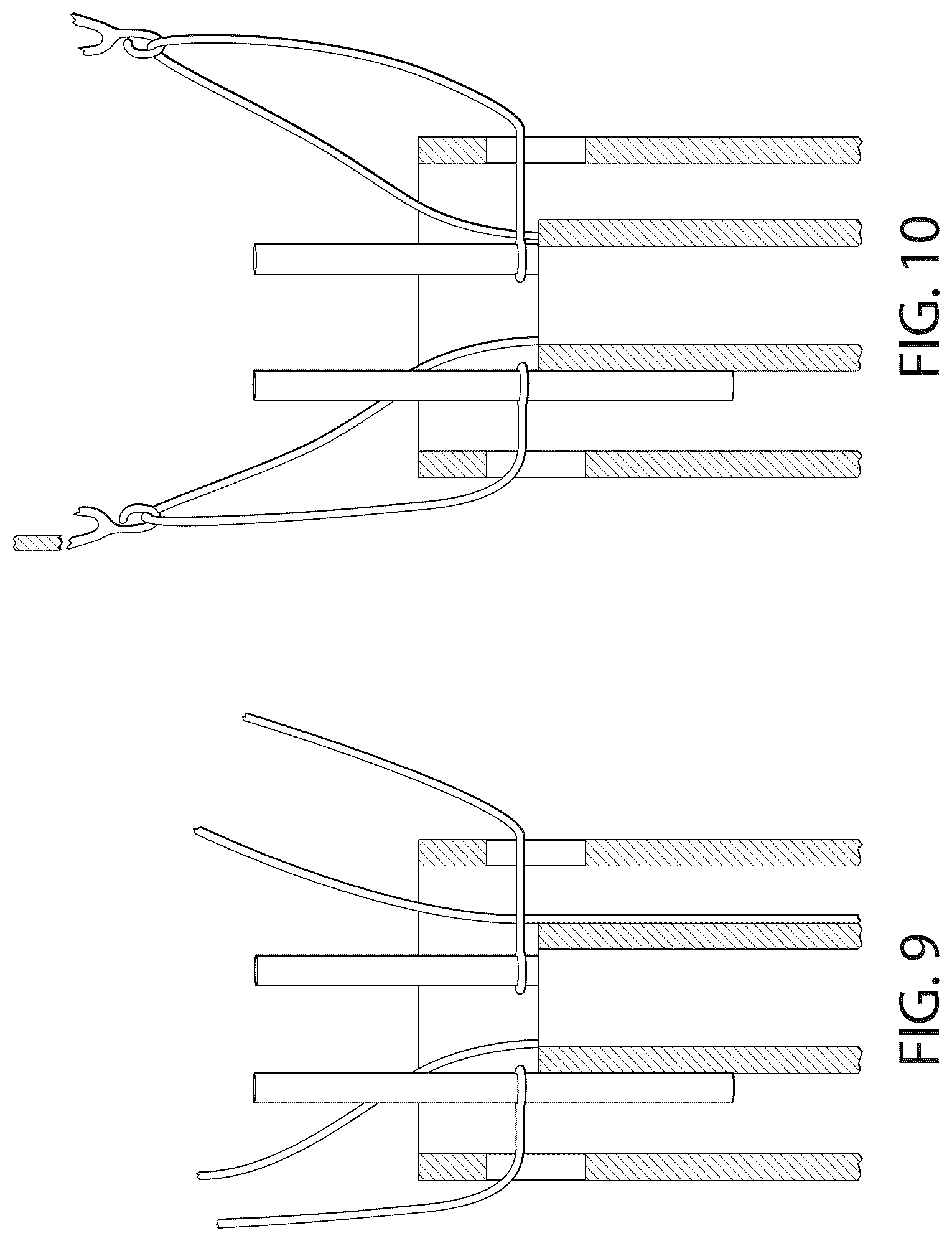 Patent US12611306 Figure 13 – Delivery systems and methods for prosthetic heart valve